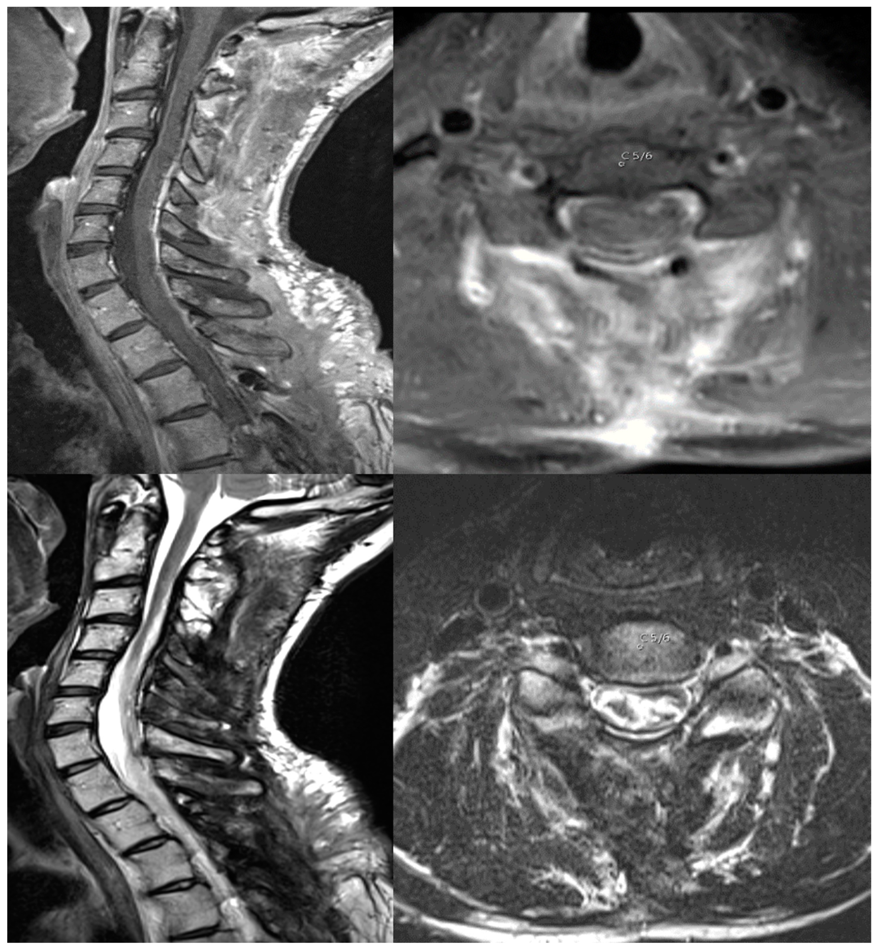 Cancers 16 01782 g002