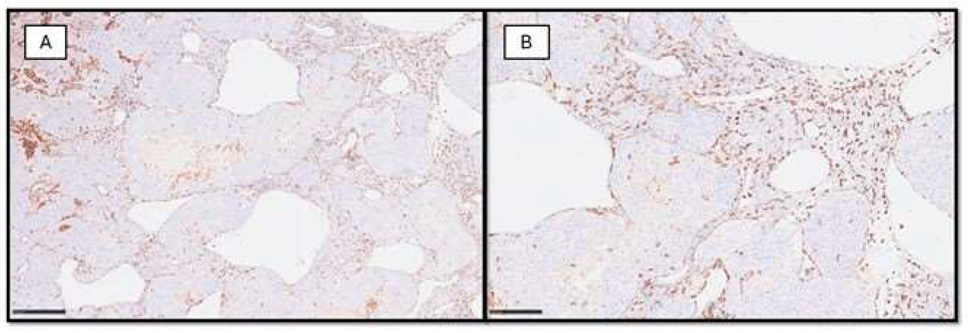 Cancers 16 01794 g002