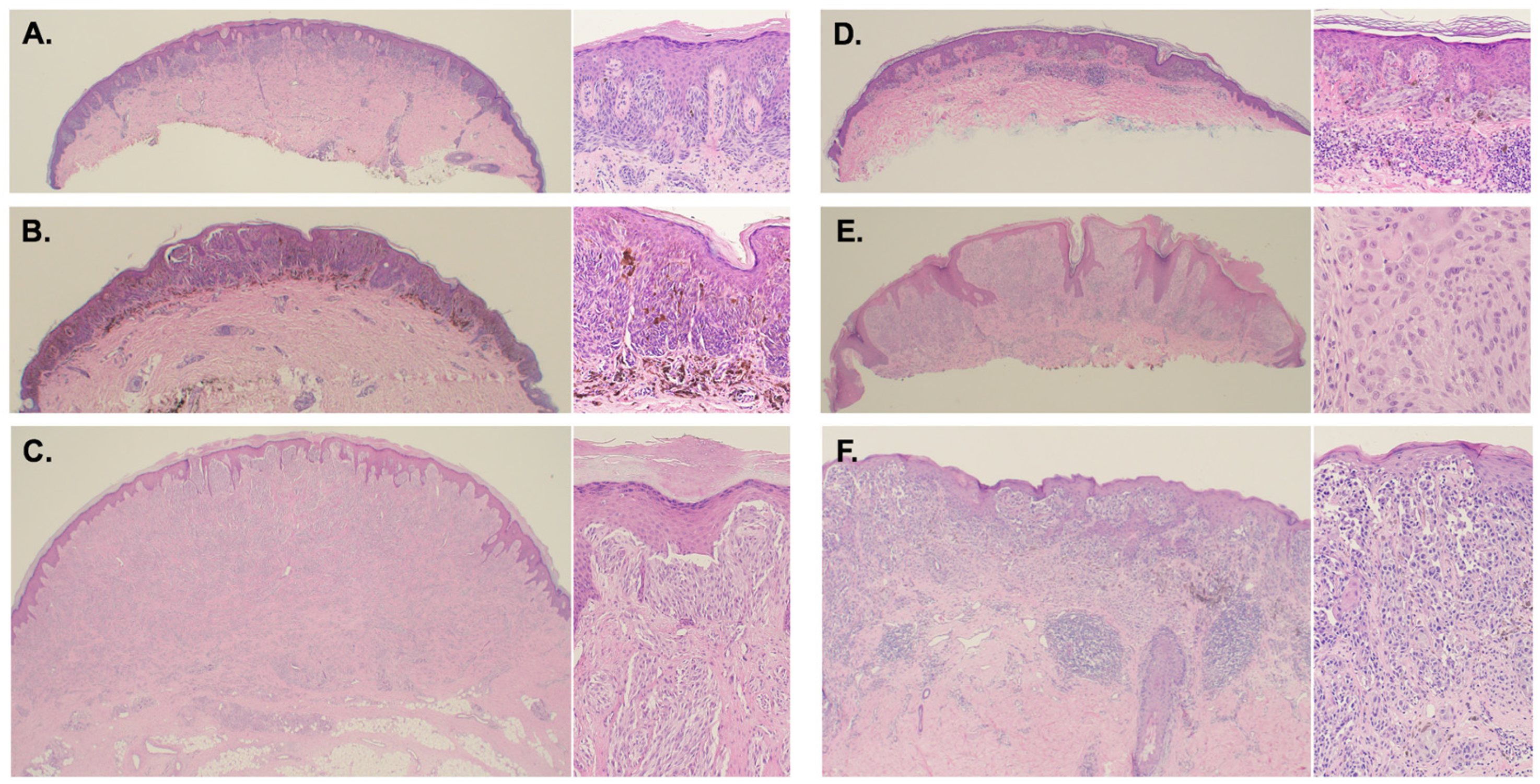 Cancers 16 01798 g001