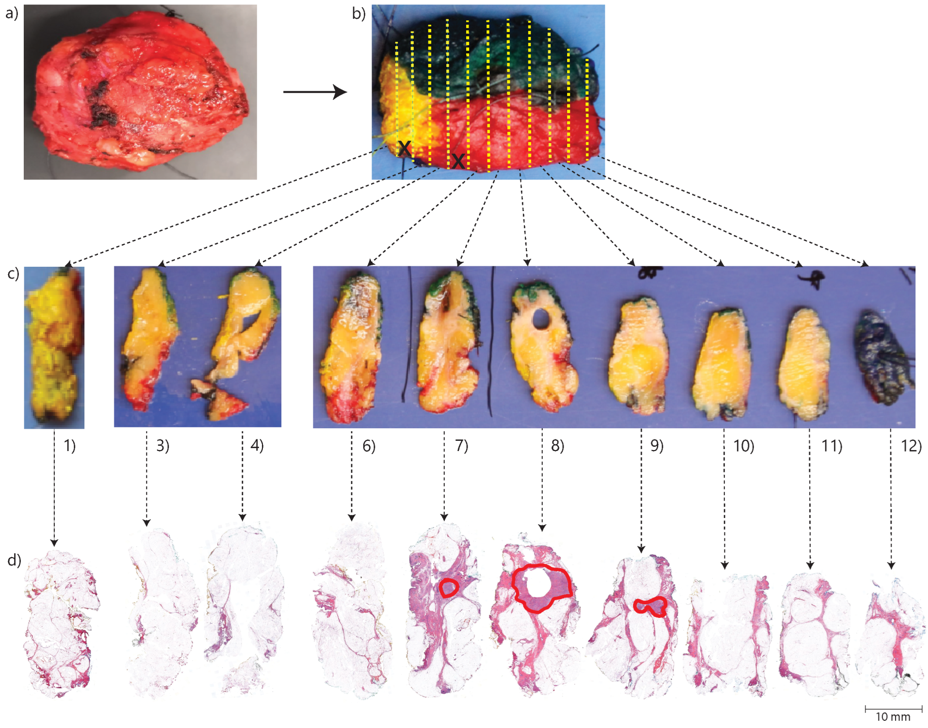 Cancers 16 01813 g001