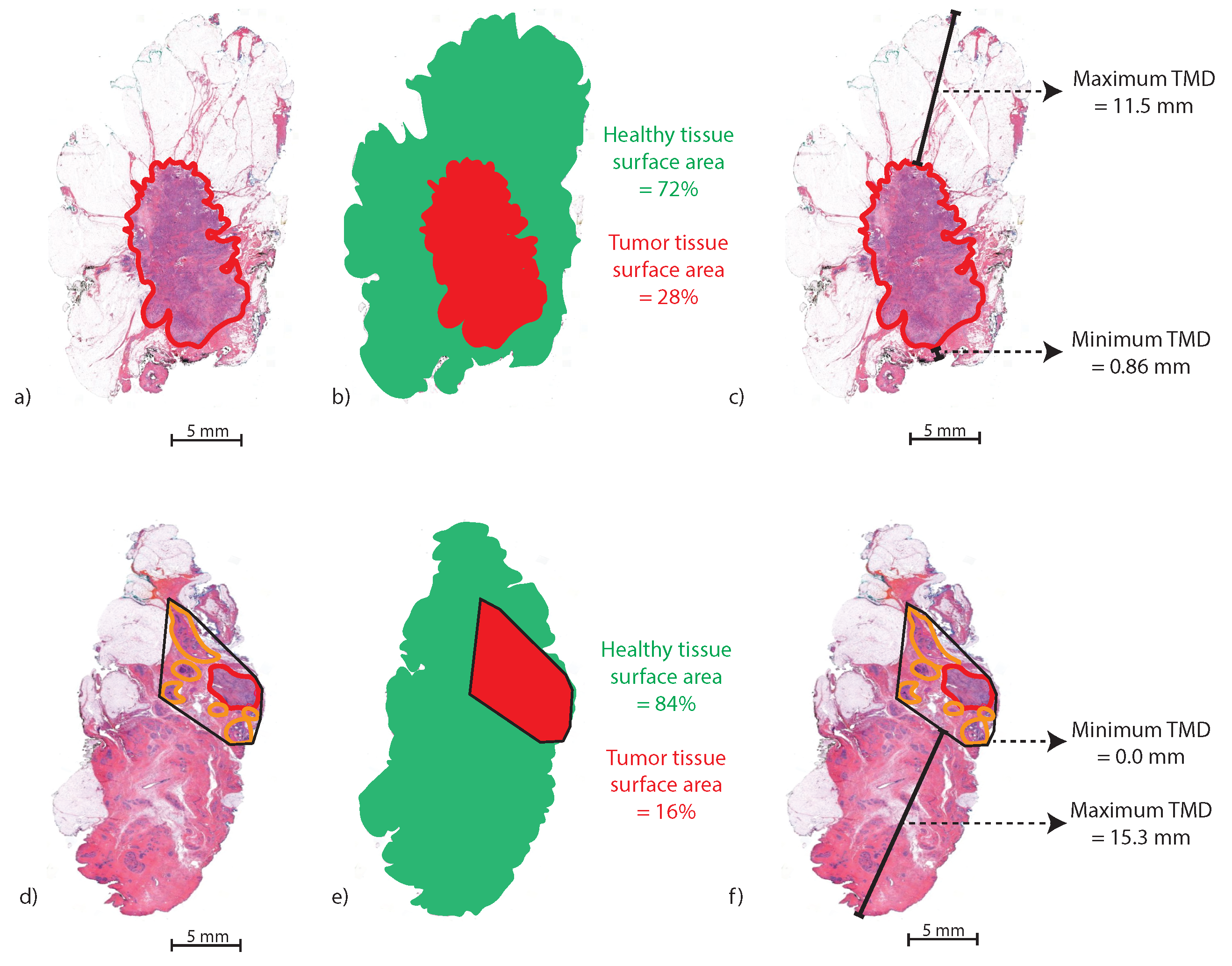 Cancers 16 01813 g002