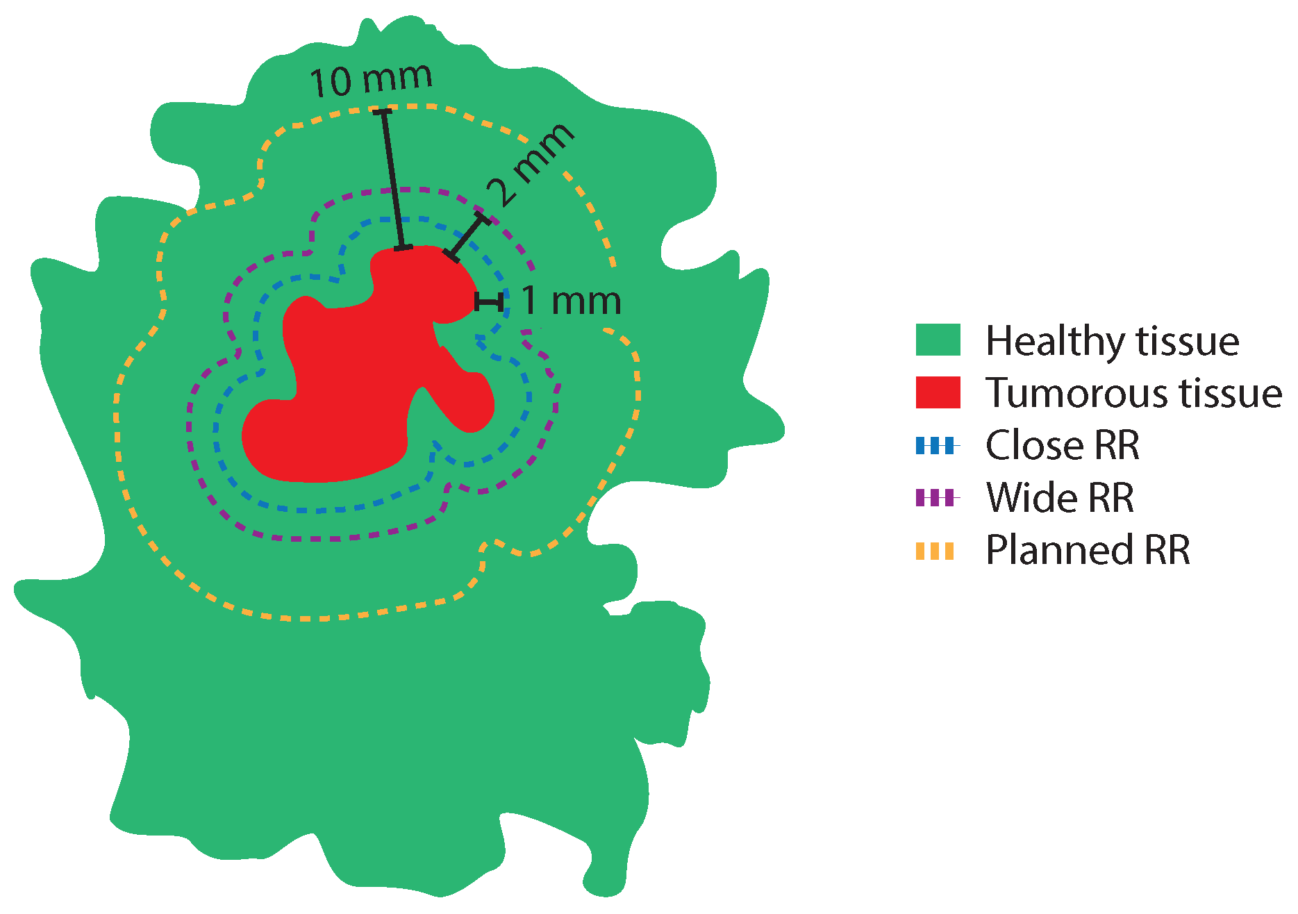 Cancers 16 01813 g003