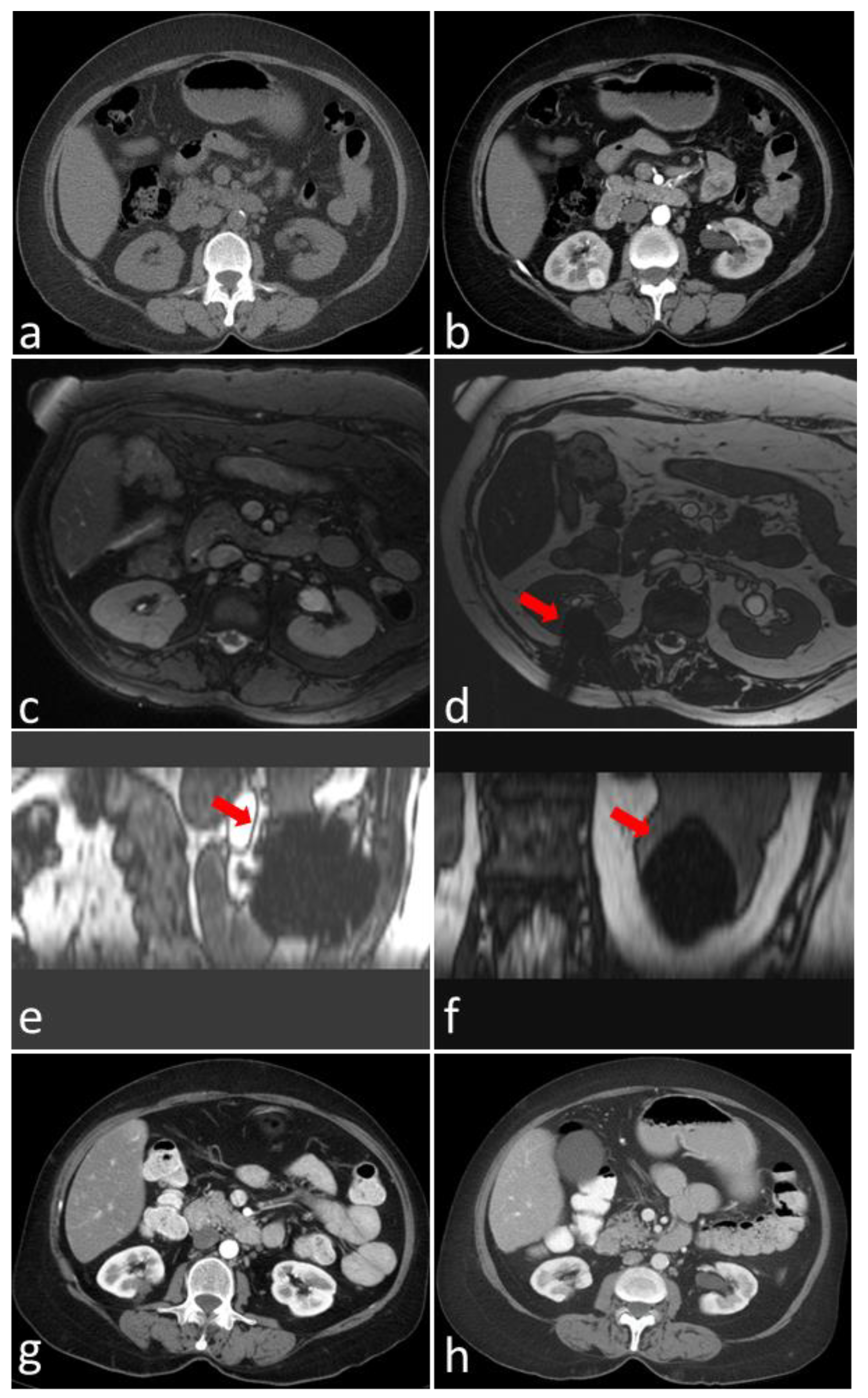 Cancers 16 01815 g001
