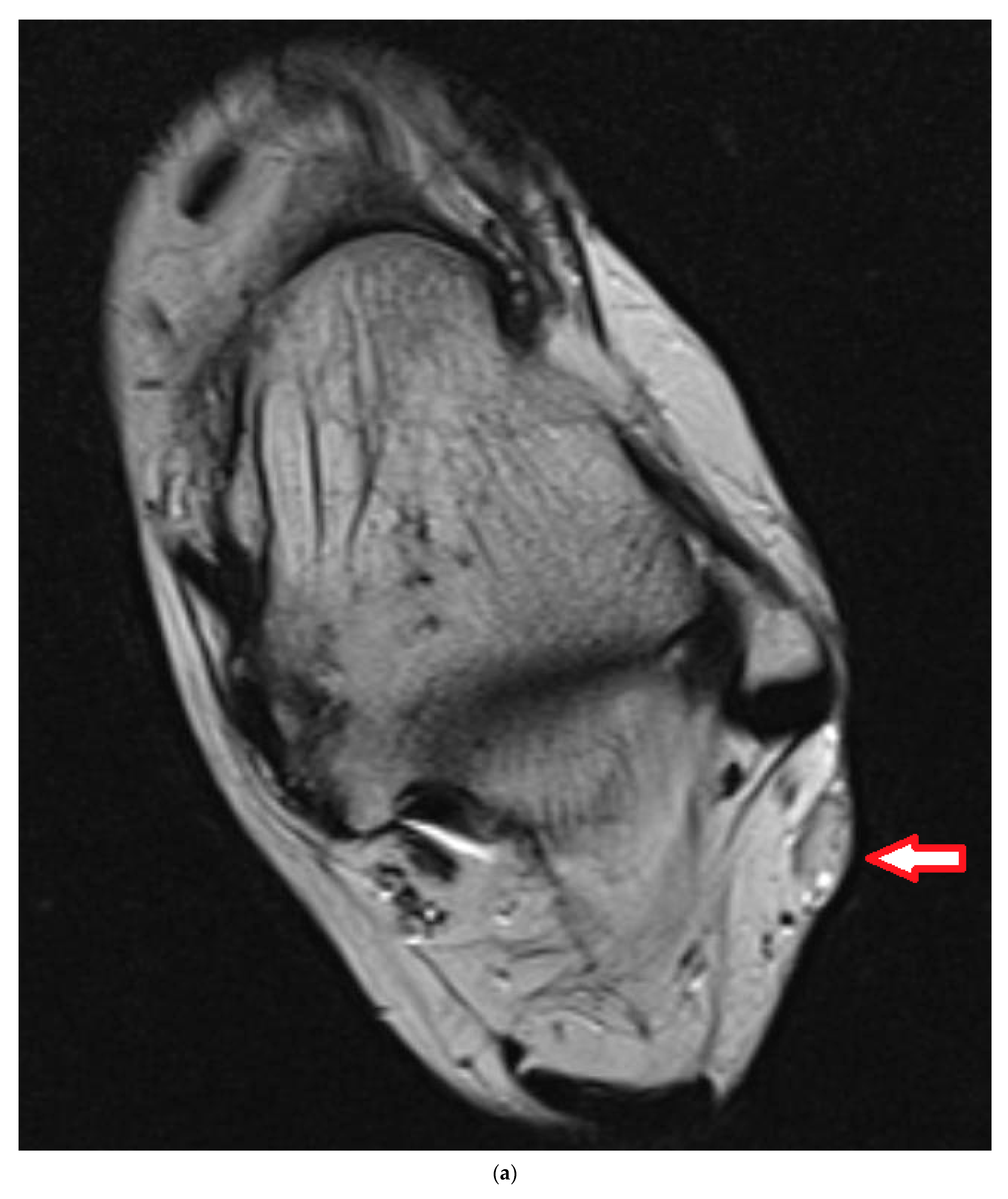 Cancers 16 01851 g005a