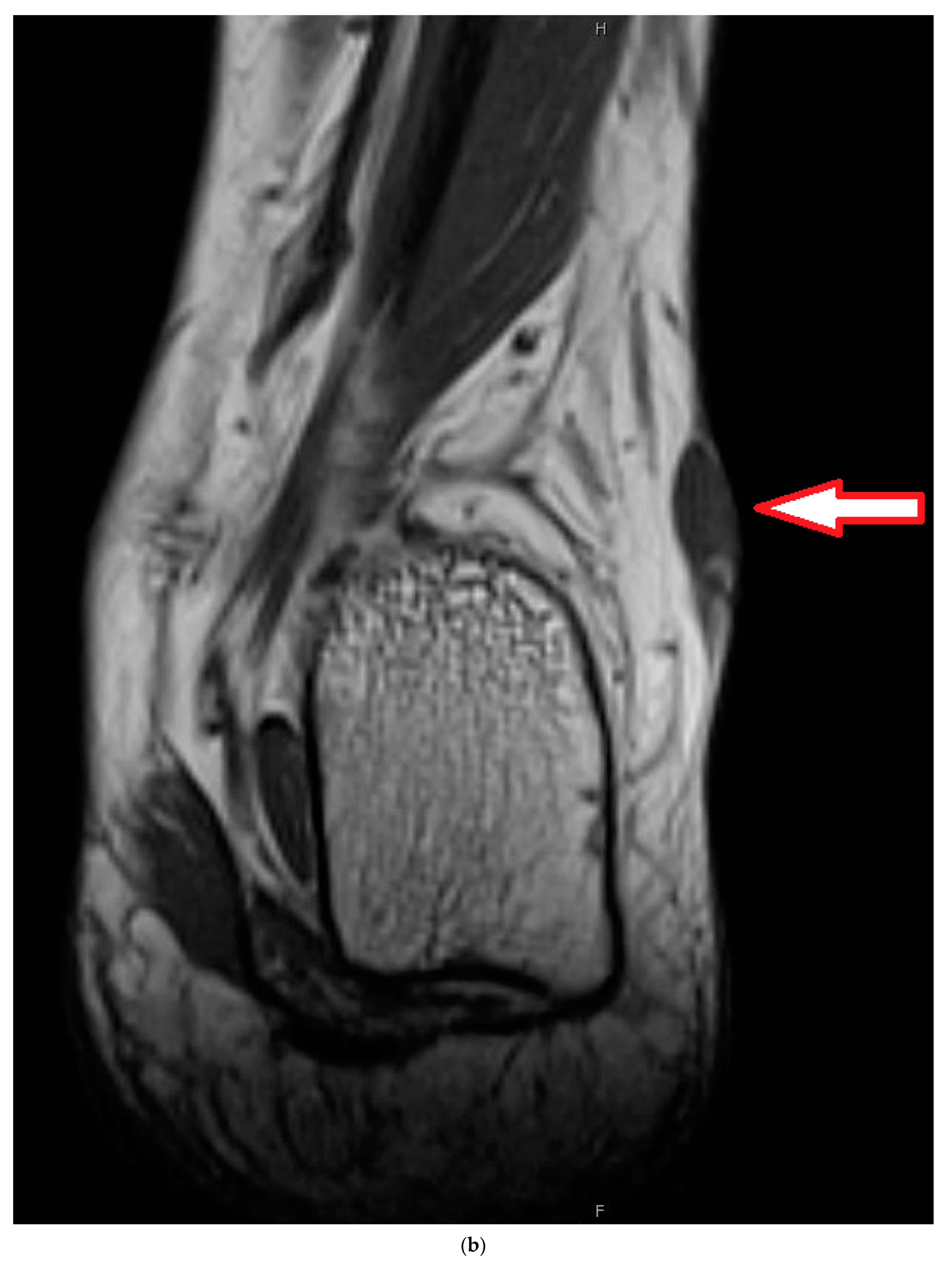 Cancers 16 01851 g005b