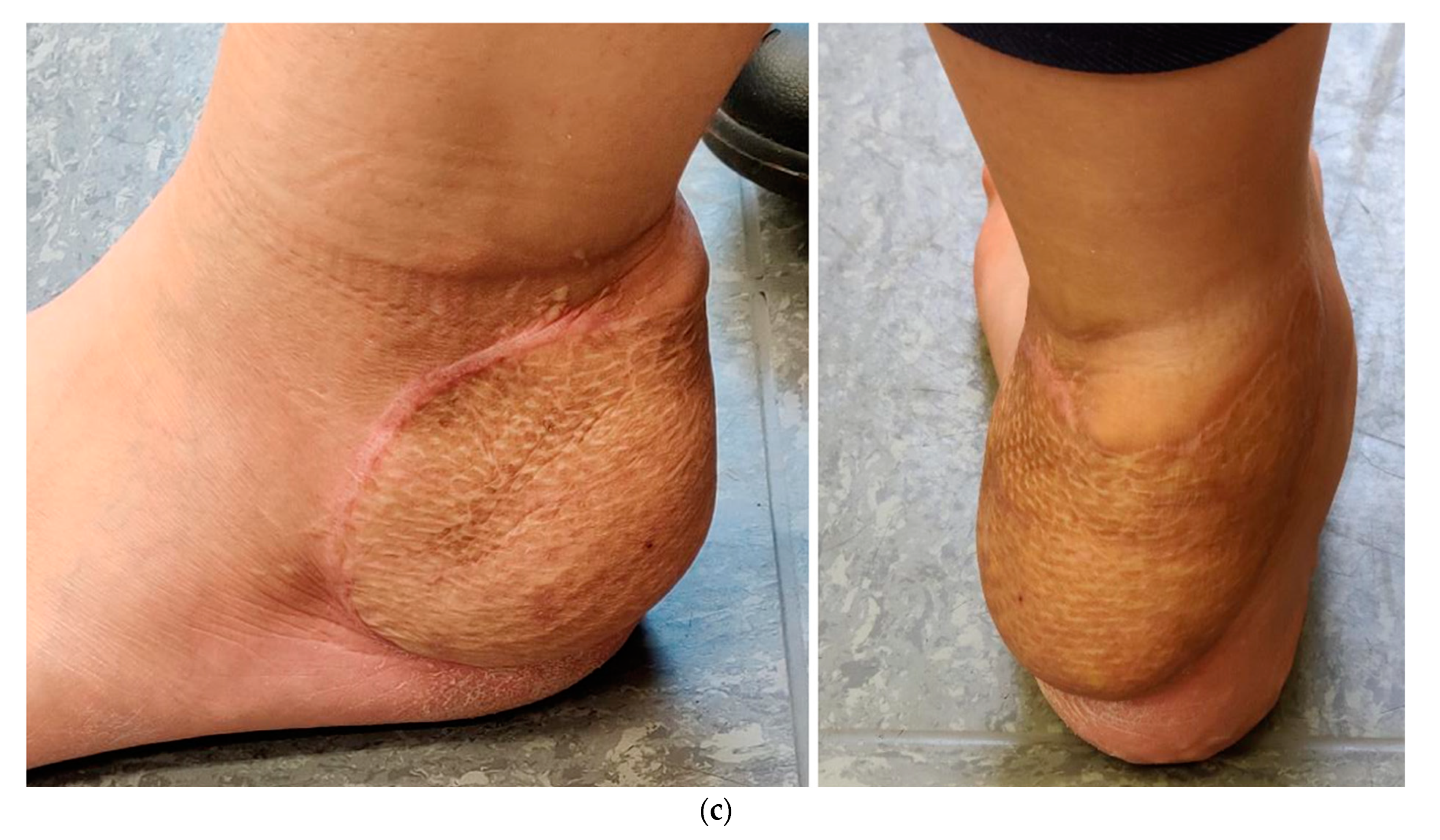 Cancers 16 01851 g005c