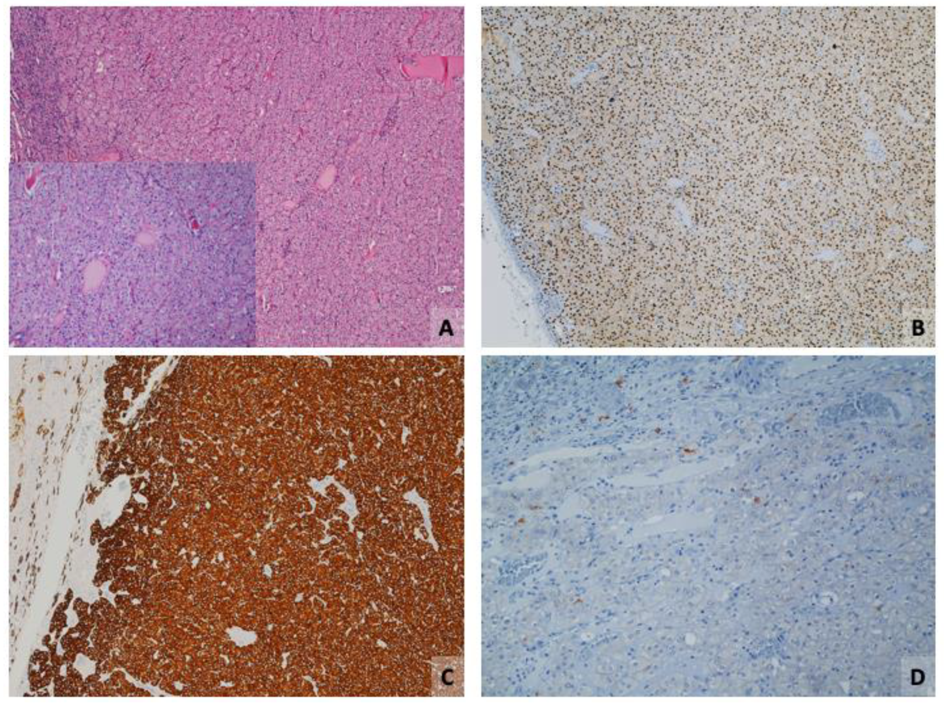 Cancers 16 01856 g002 Cancers 16 01856 g002