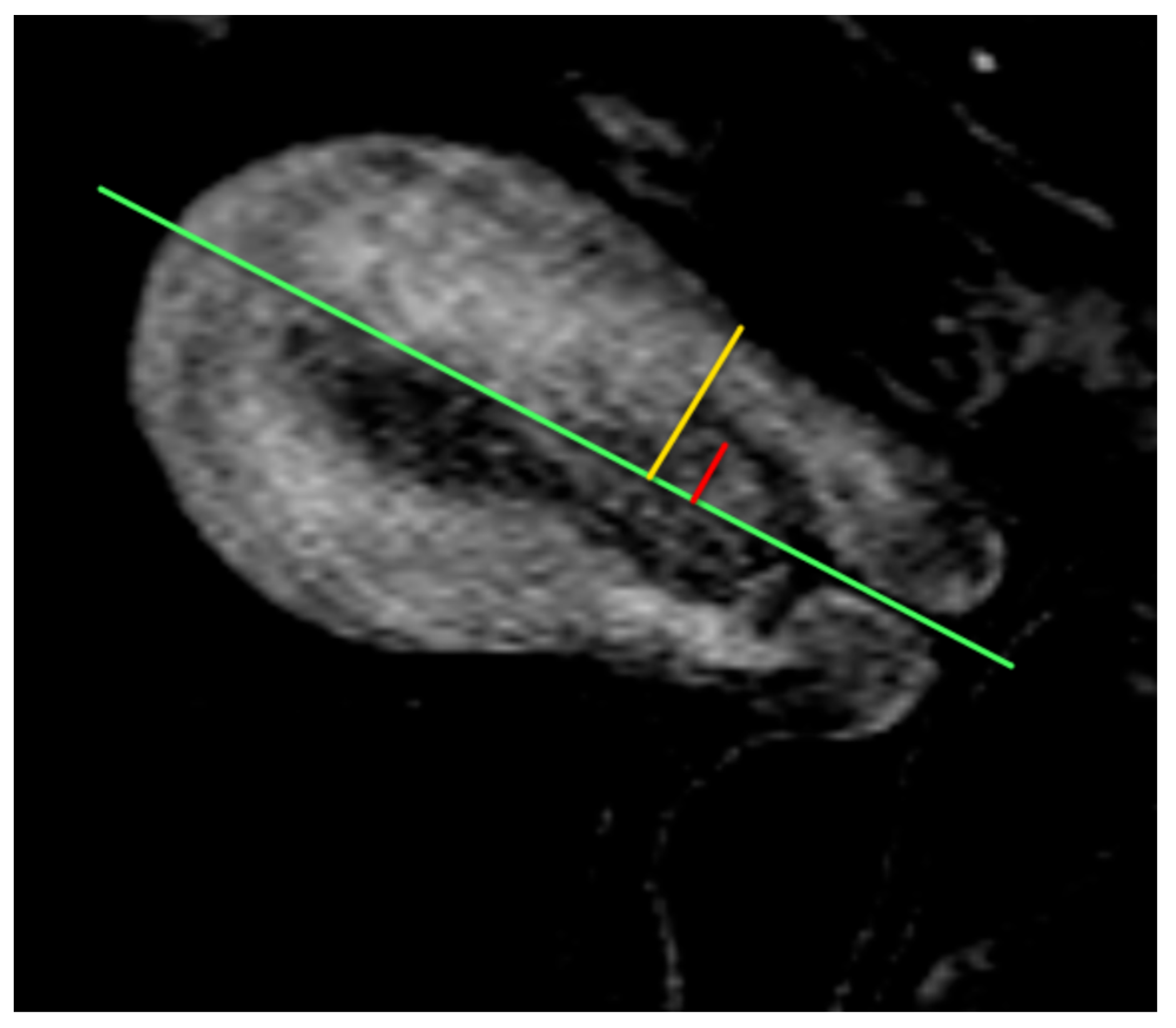 Cancers 16 01869 g005