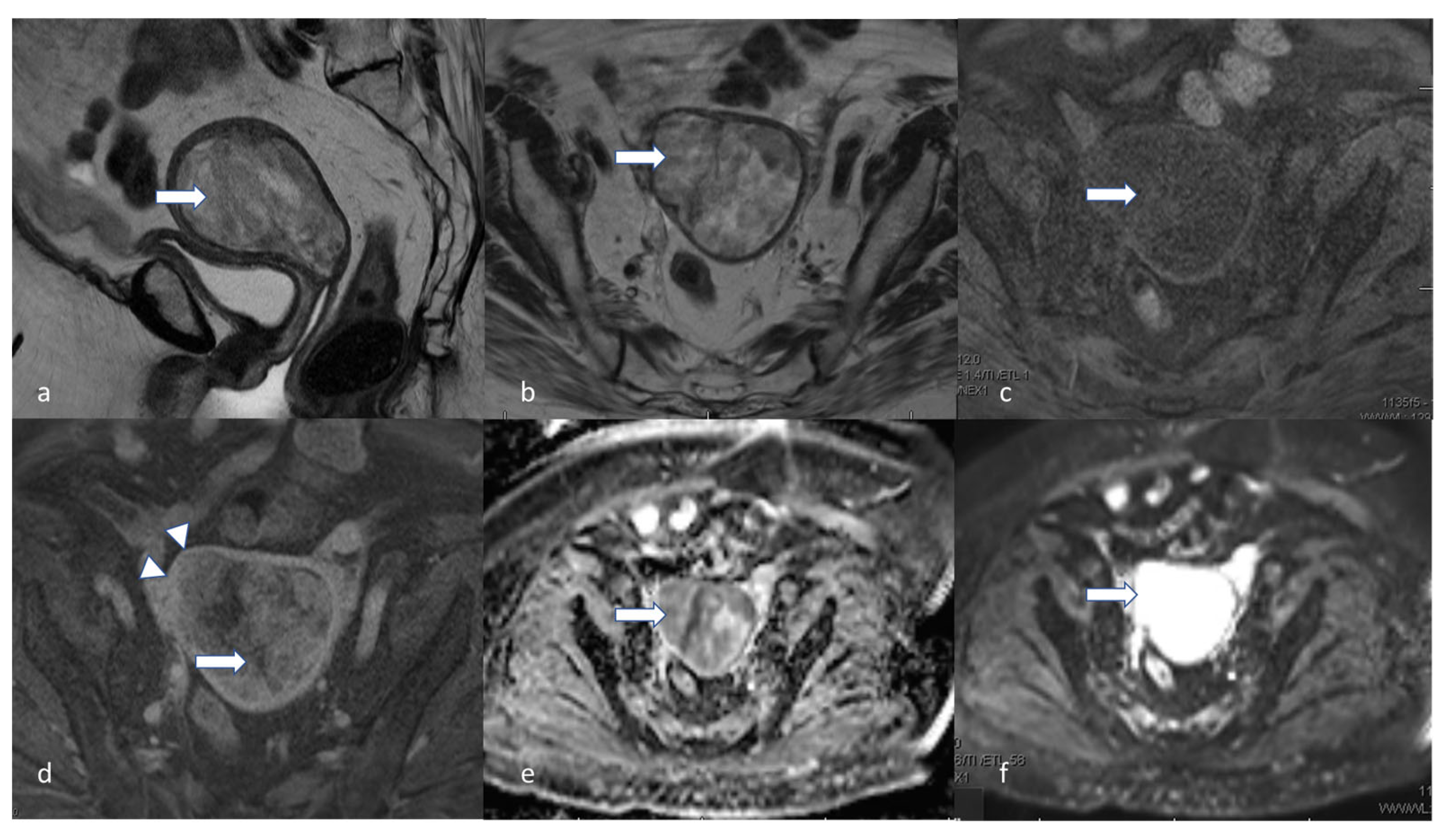 Cancers 16 01869 g009