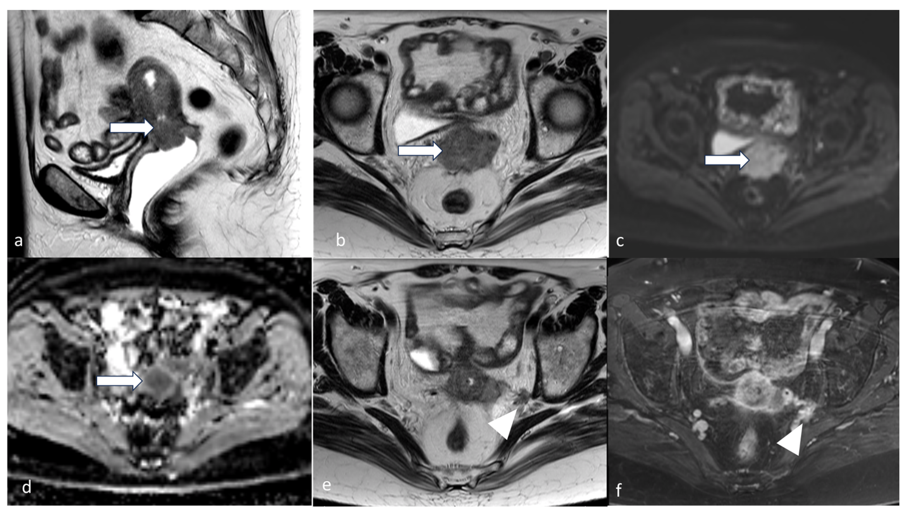 Cancers 16 01869 g011