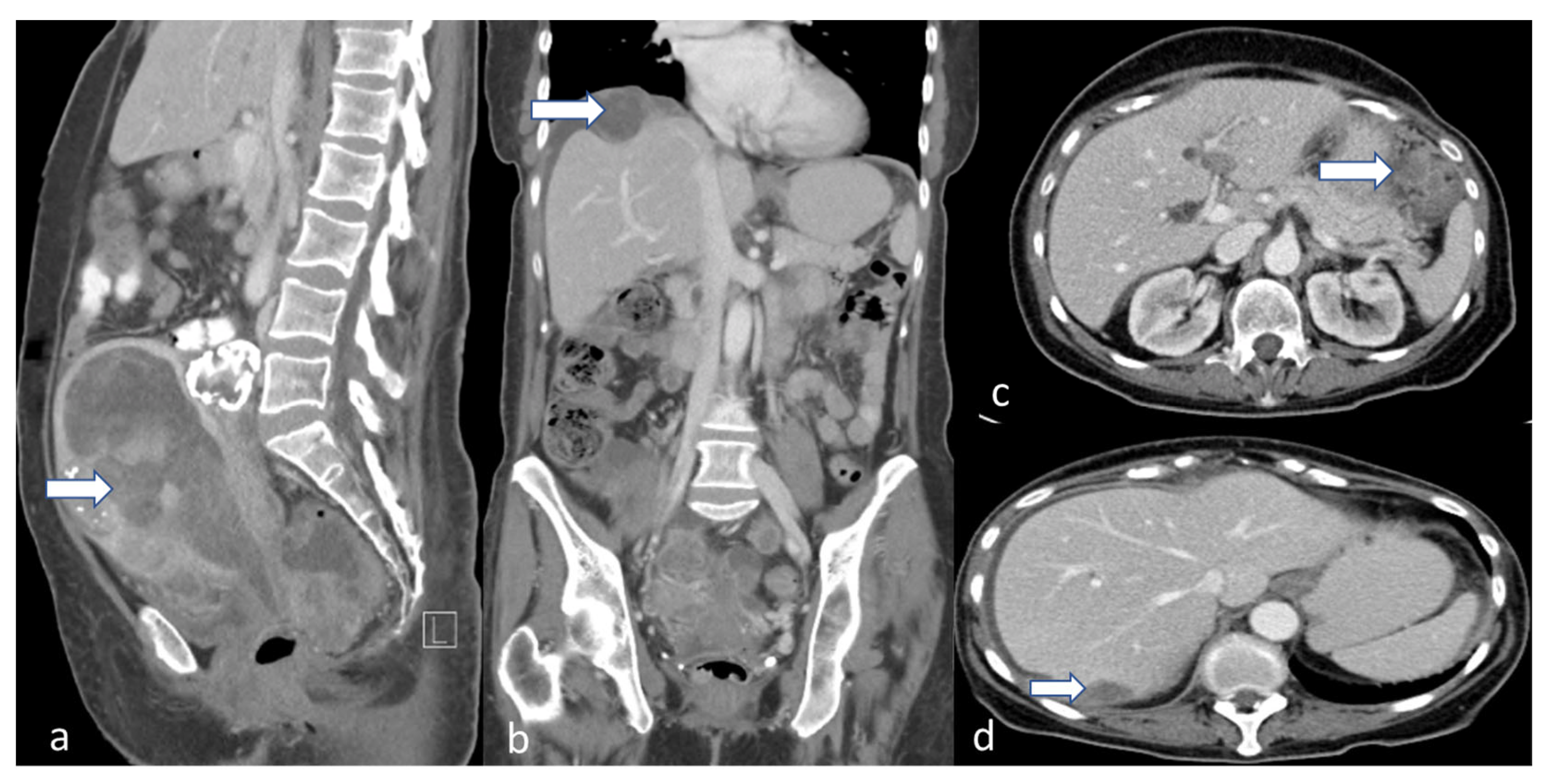 Cancers 16 01869 g014