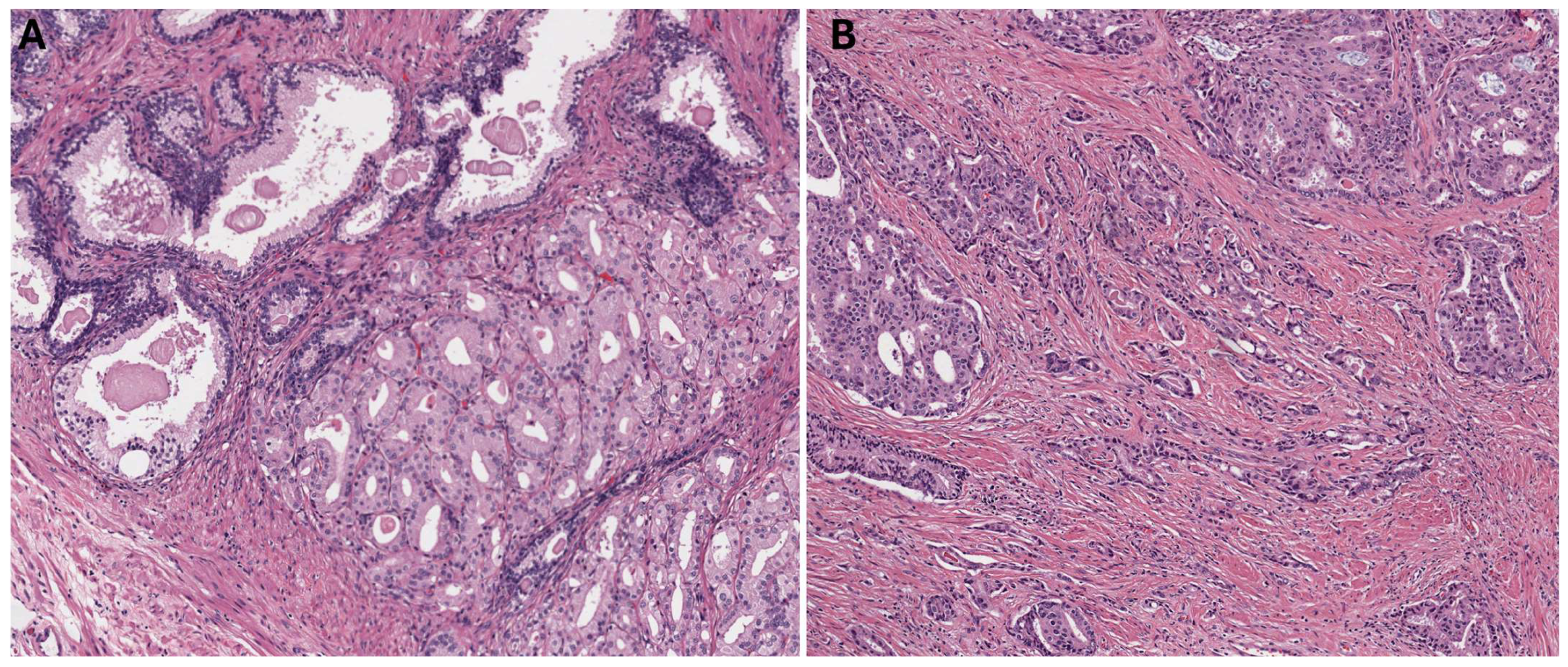 Cancers 16 01871 g001