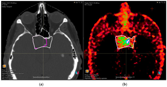 Cancers | Free Full-Text | The Value of PET/CT in Particle Therapy ...