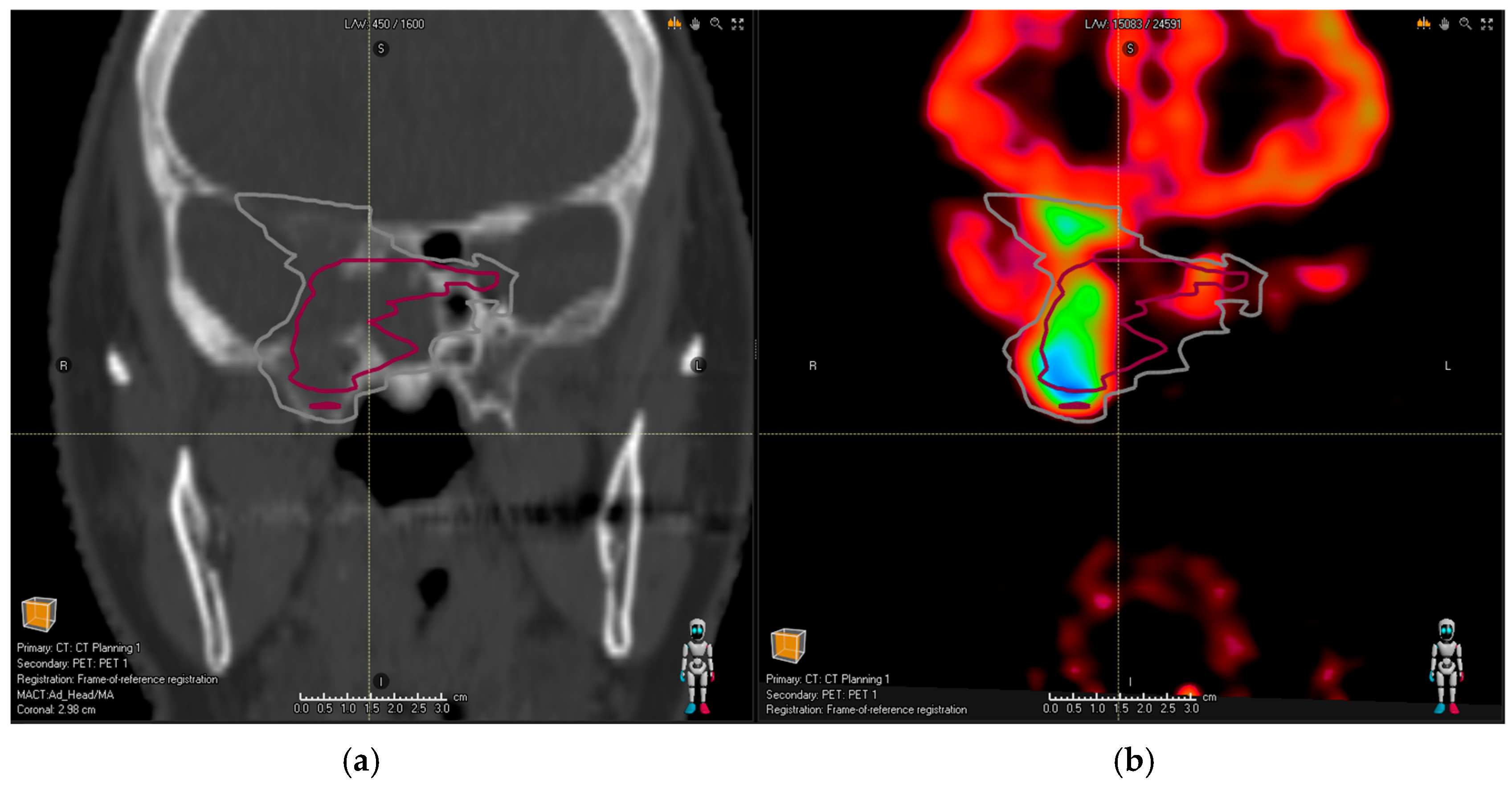 Cancers 16 01877 g002