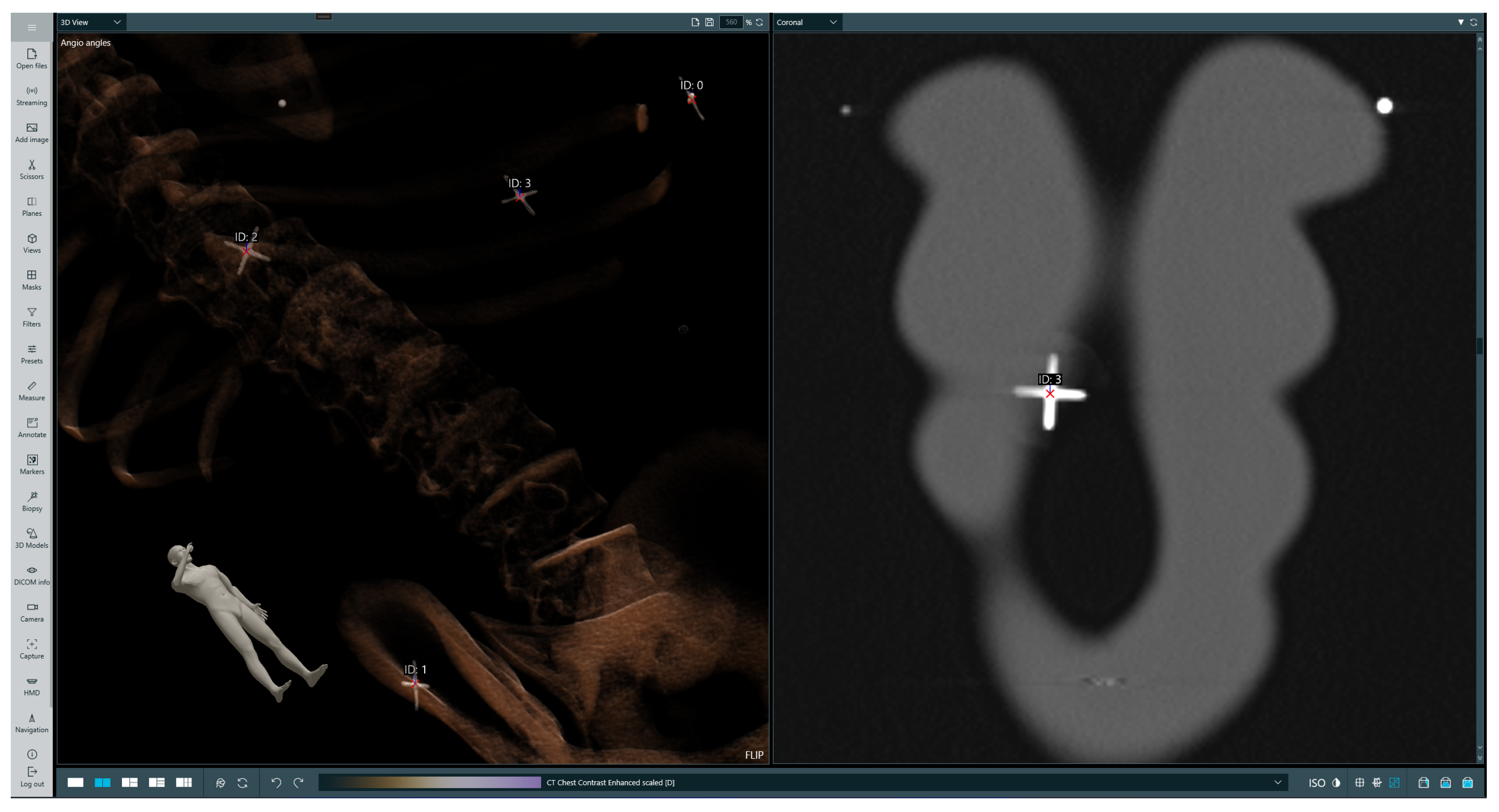 Cancers 16 01894 g005