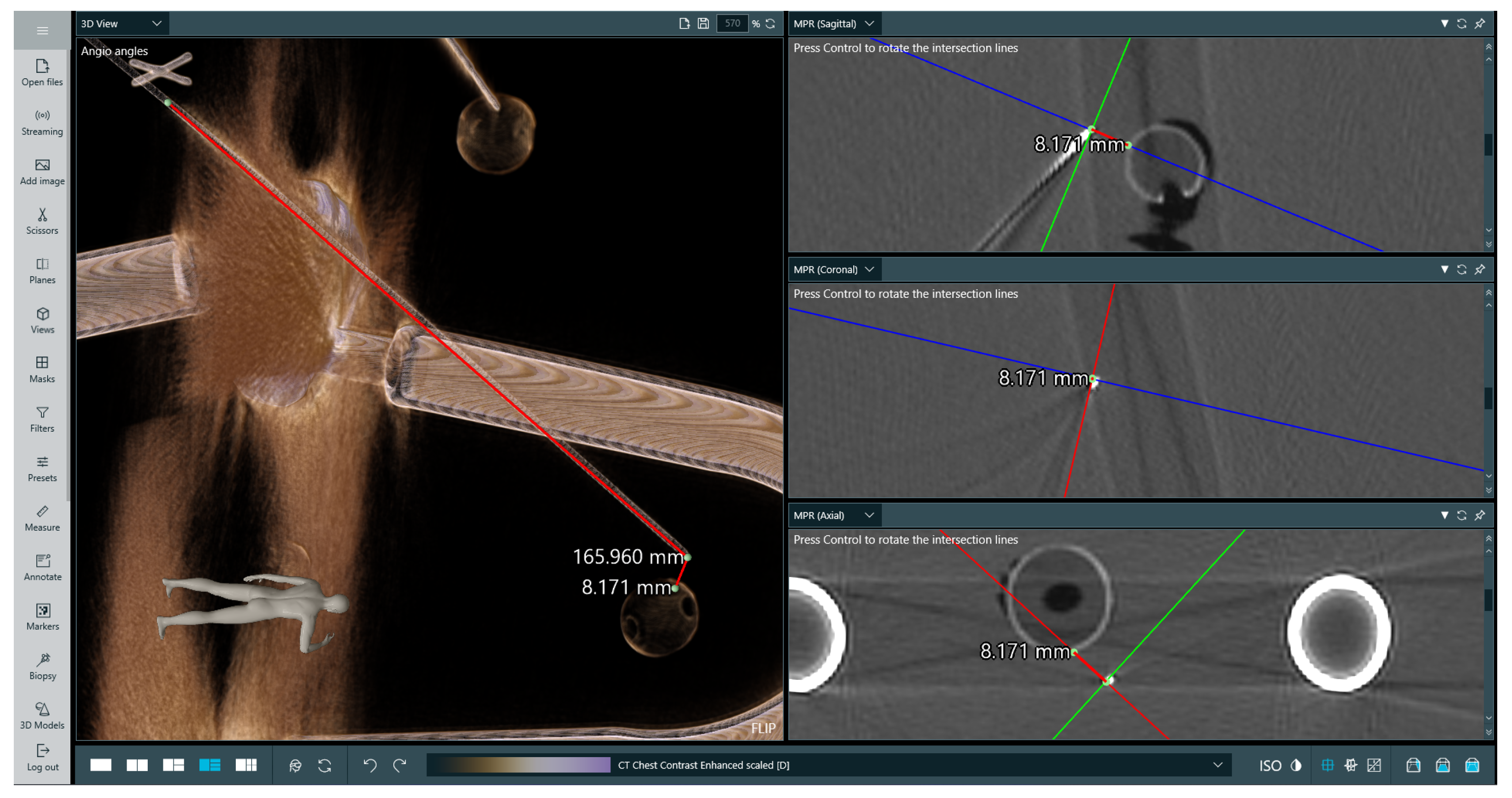 Cancers 16 01894 g008