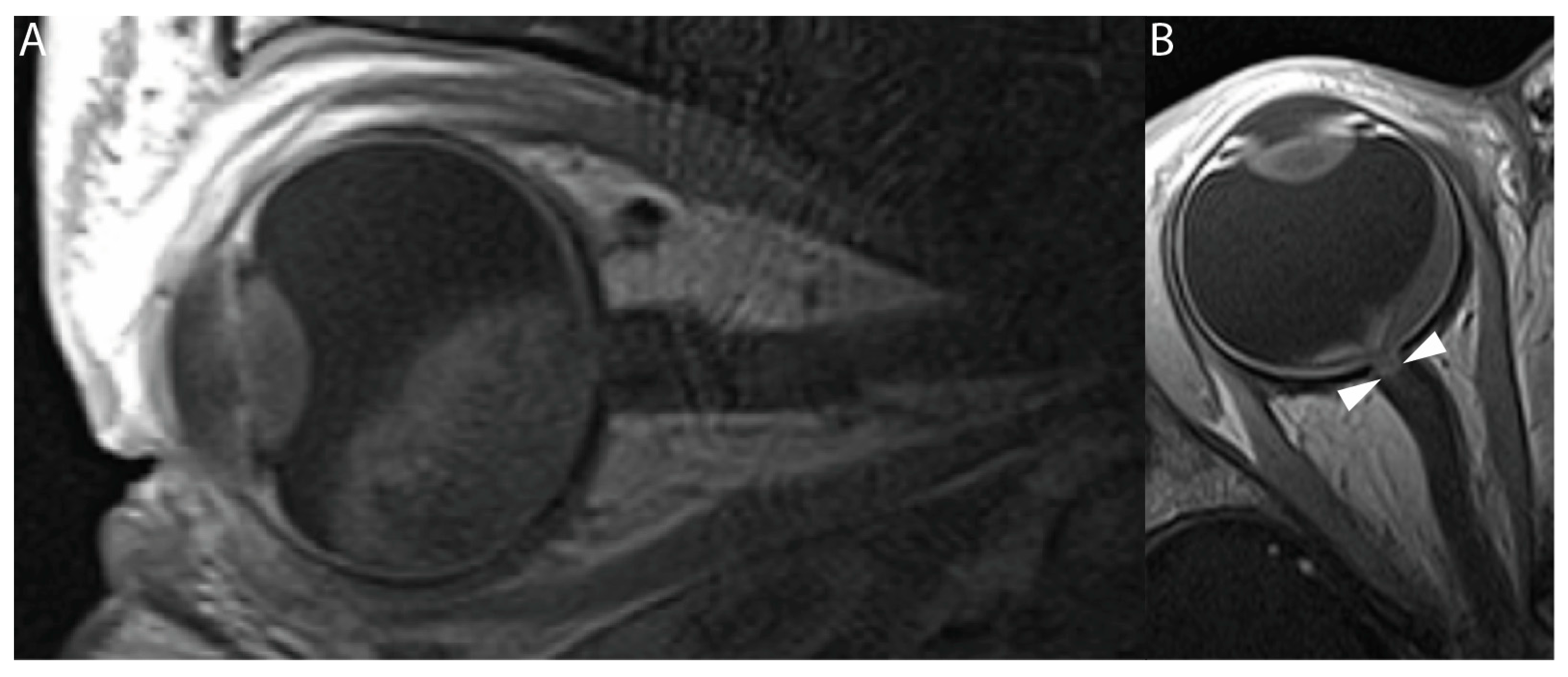 Cancers 16 01899 g003