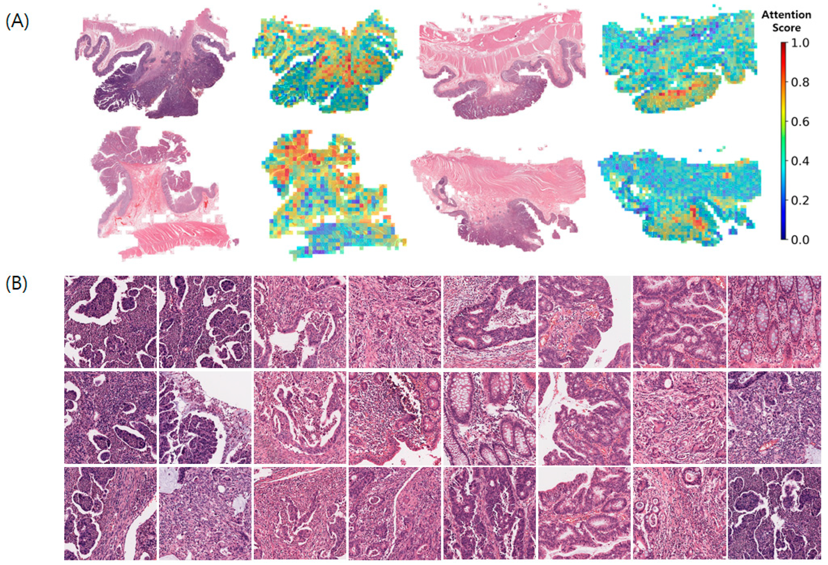 Cancers 16 01900 g004