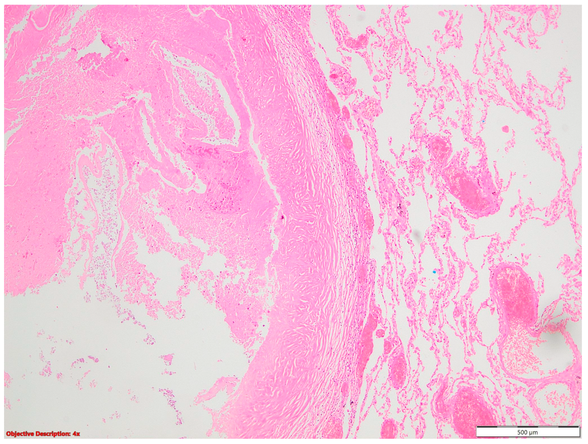 Cancers 16 01903 g001