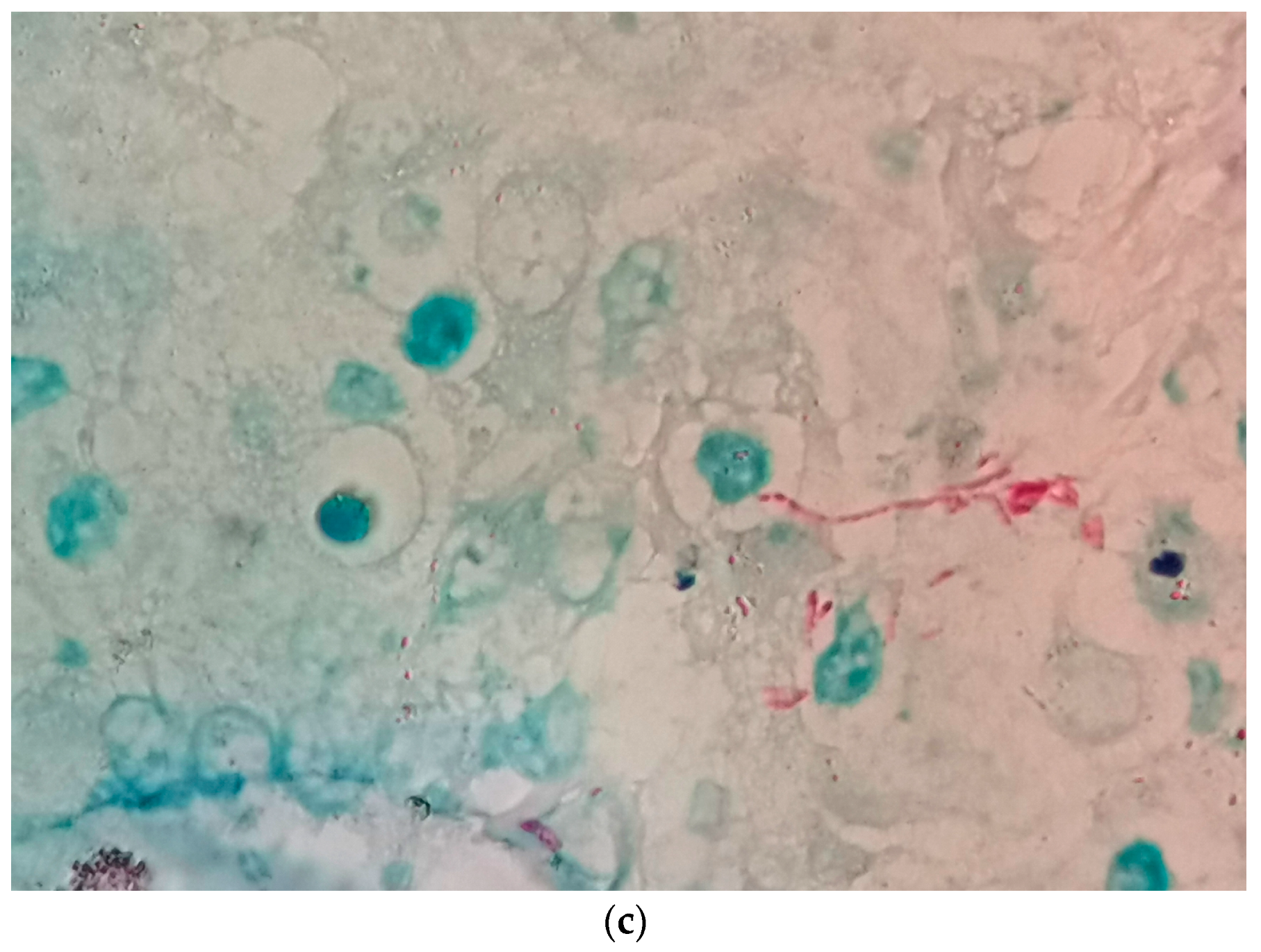 Cancers 16 01903 g002b