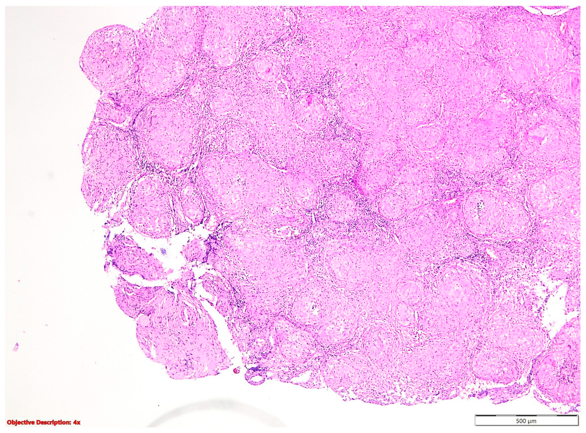 Cancers 16 01903 g003