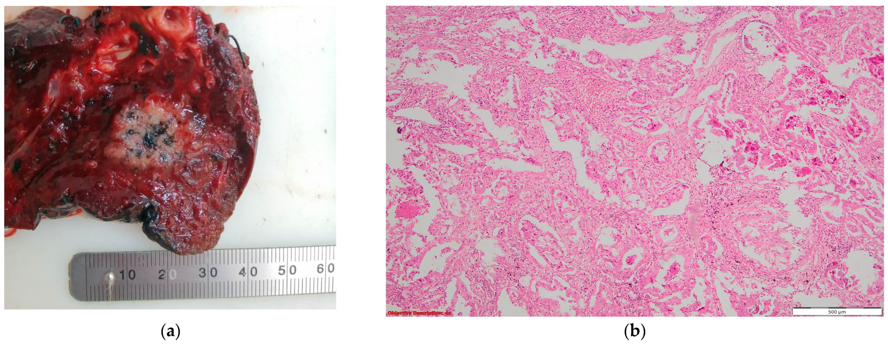 Cancers 16 01903 g006