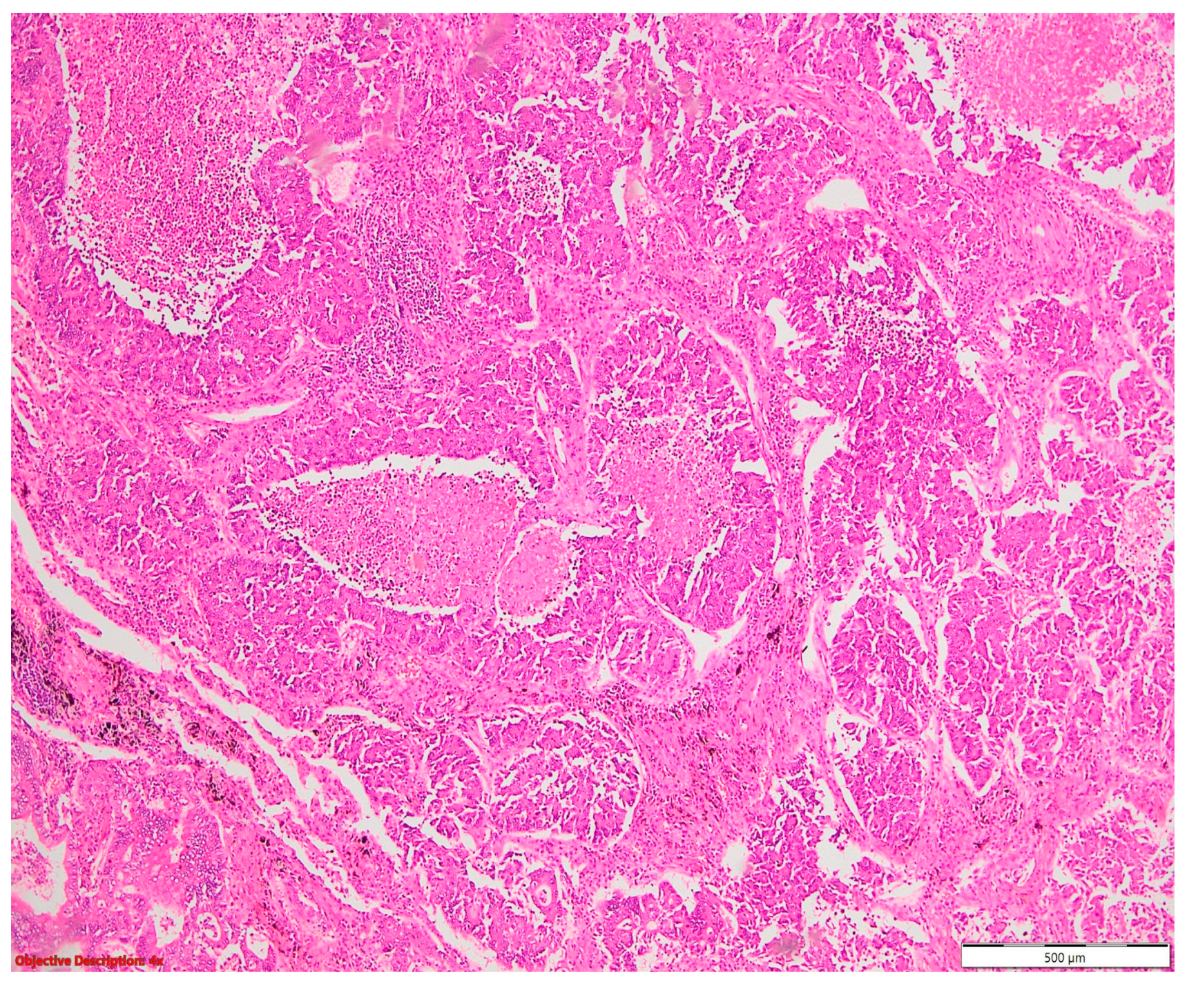 Cancers 16 01903 g008