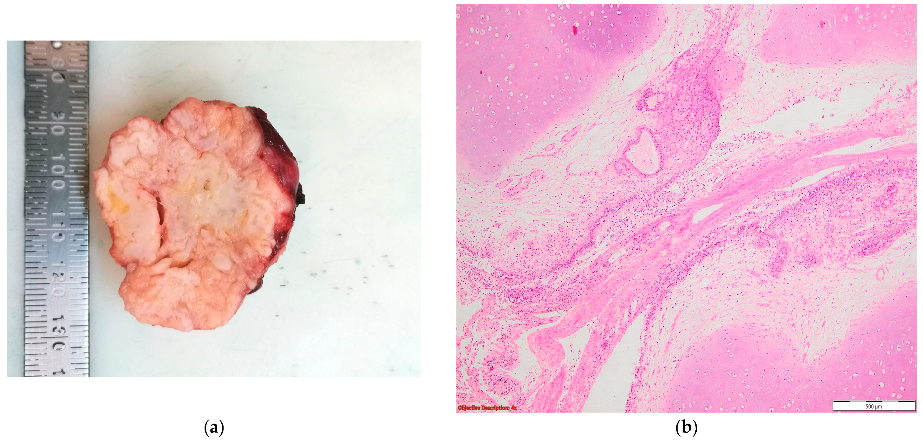 Cancers 16 01903 g009