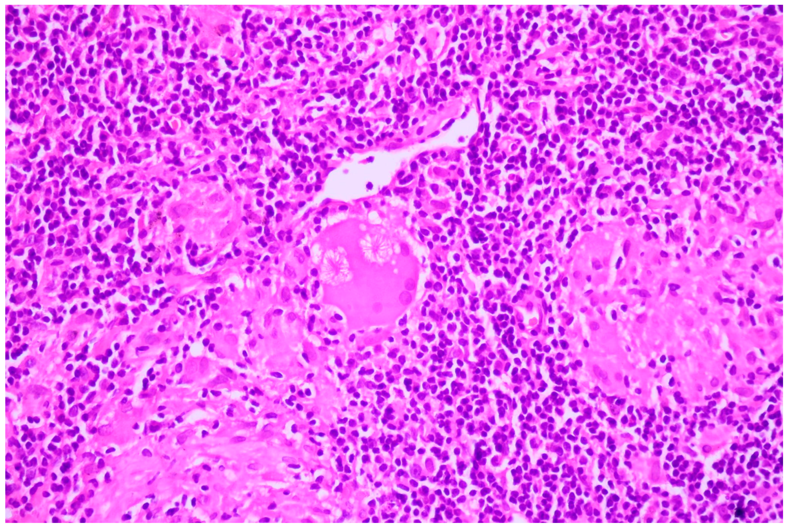 Cancers 16 01903 g011