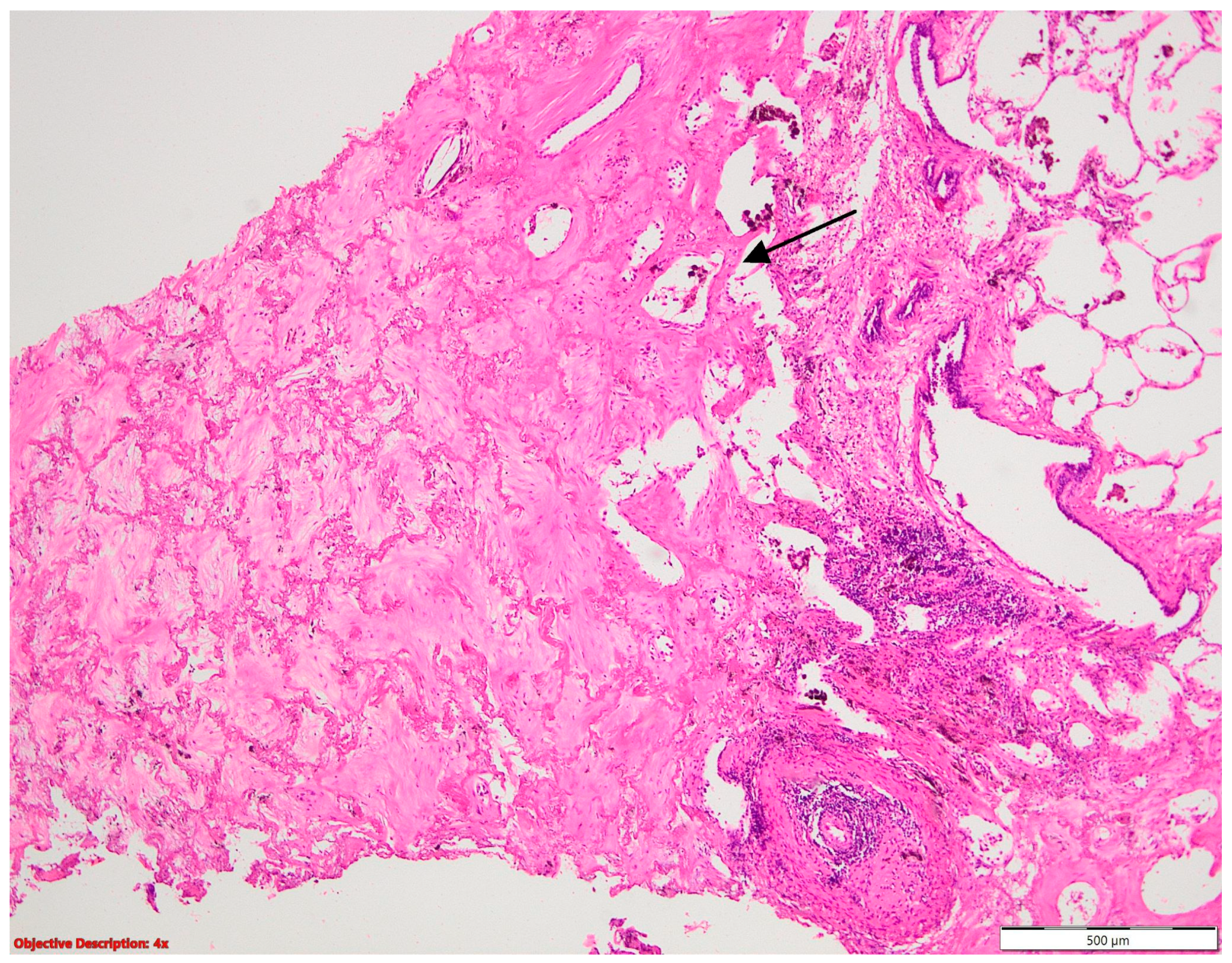 Cancers 16 01903 g012