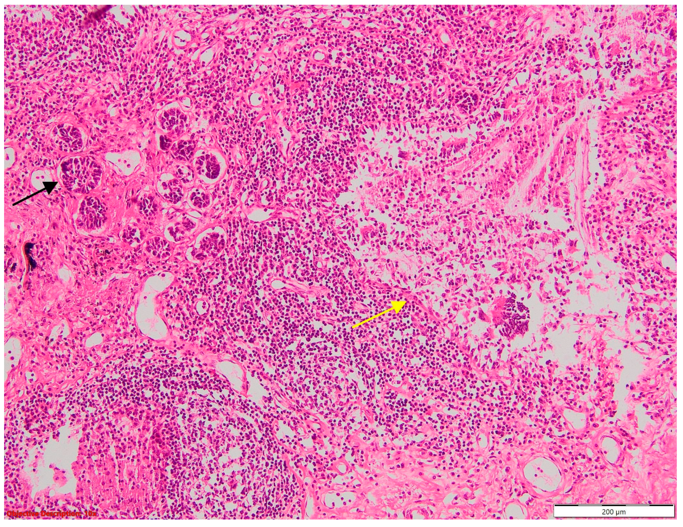 Cancers 16 01903 g014