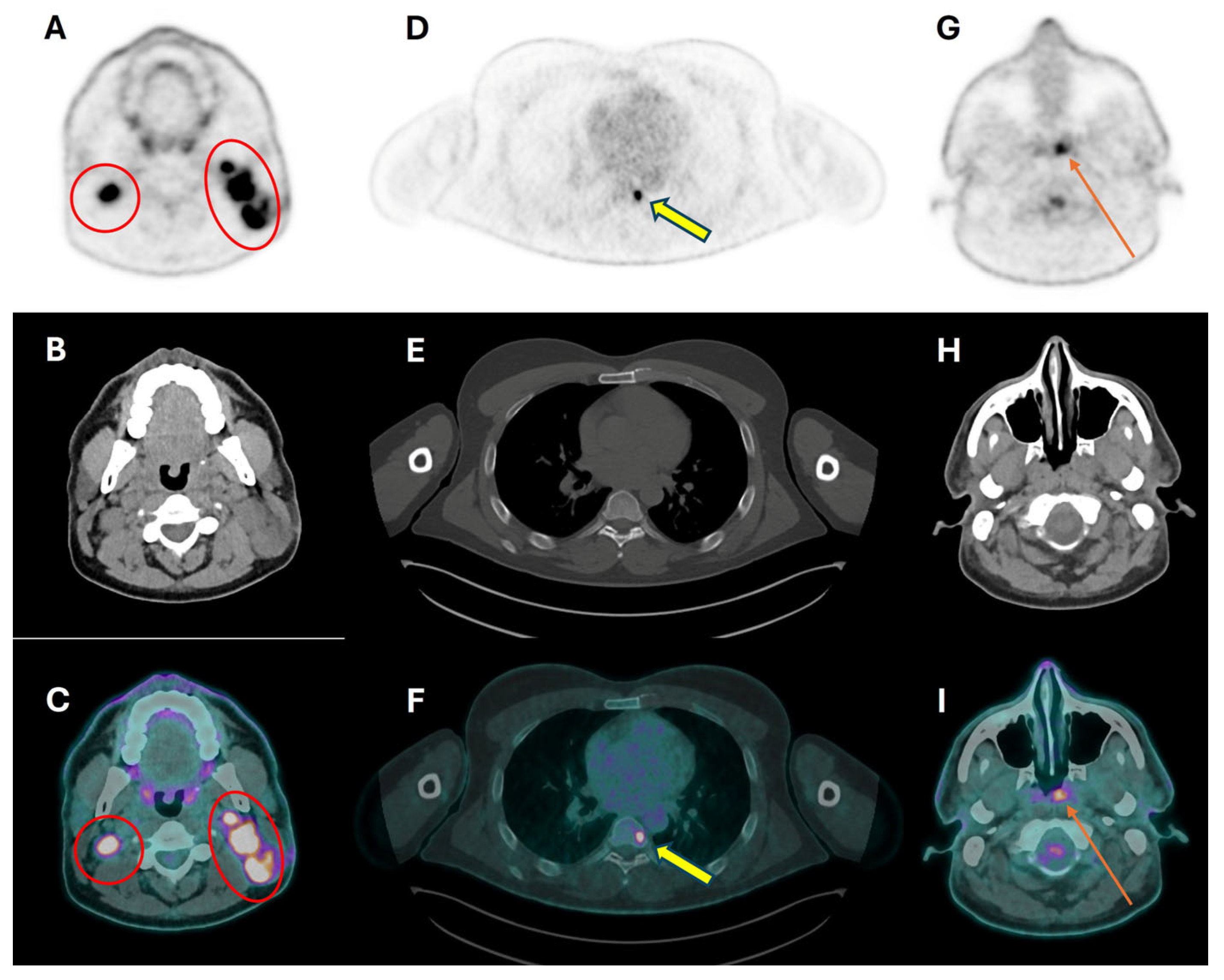 Cancers 16 01905 g002