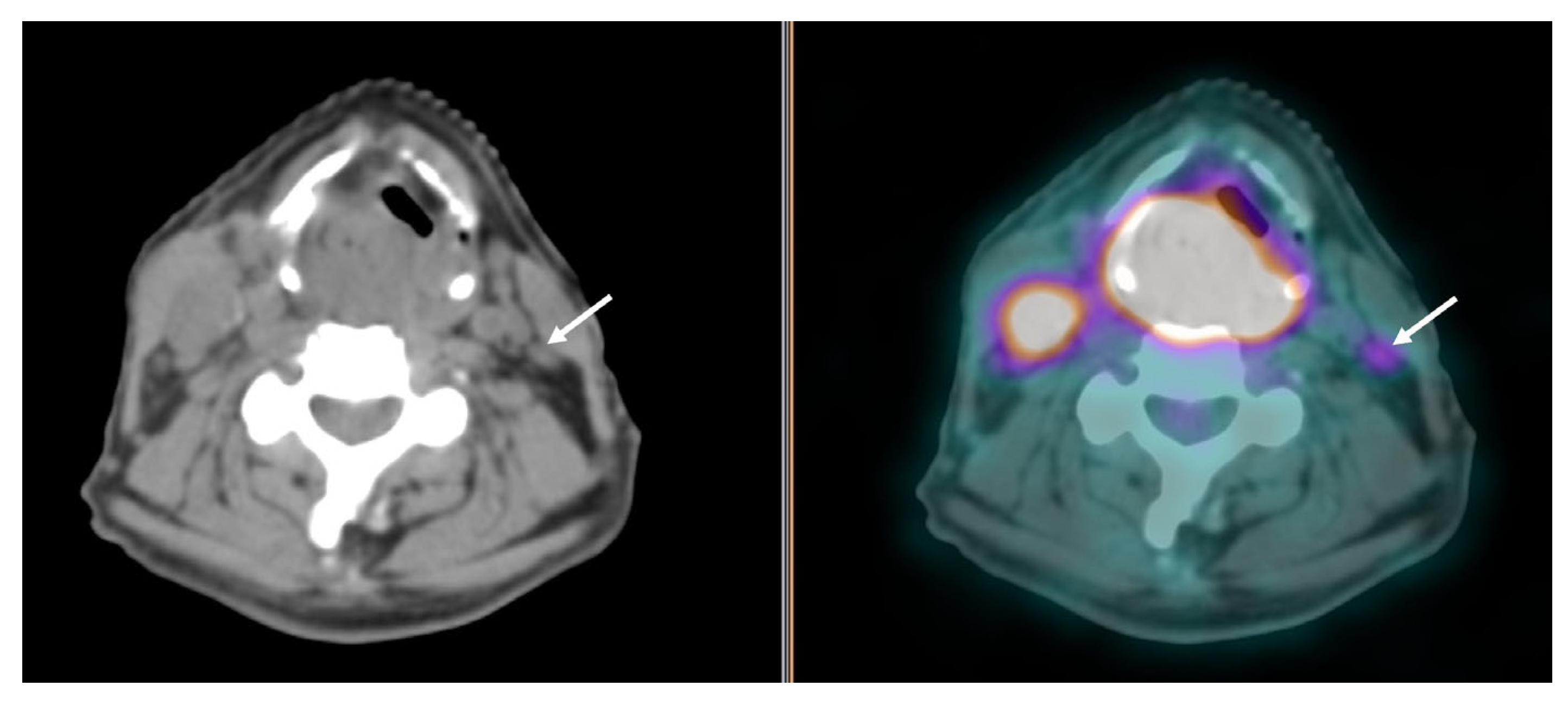 Cancers 16 01905 g003