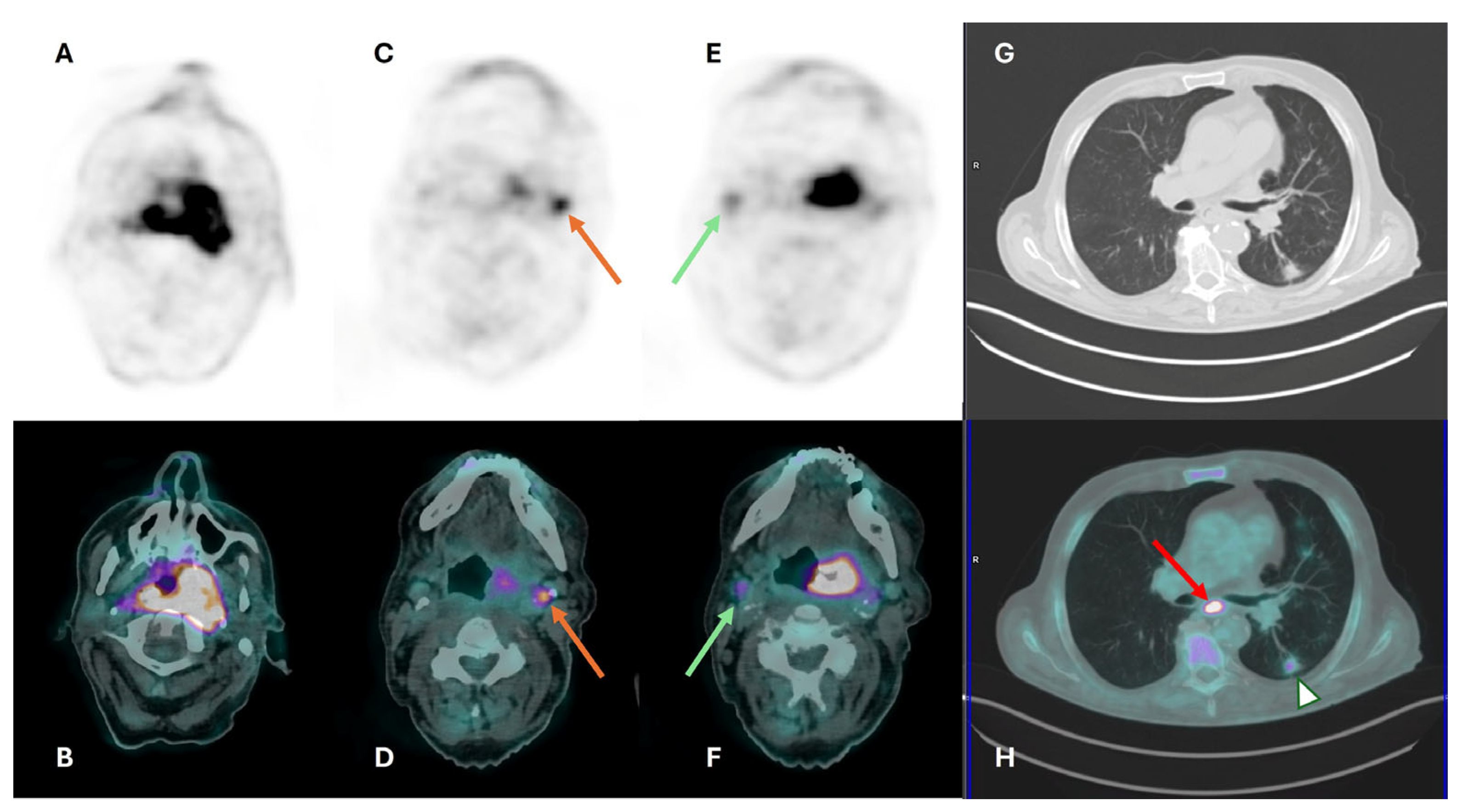 Cancers 16 01905 g005