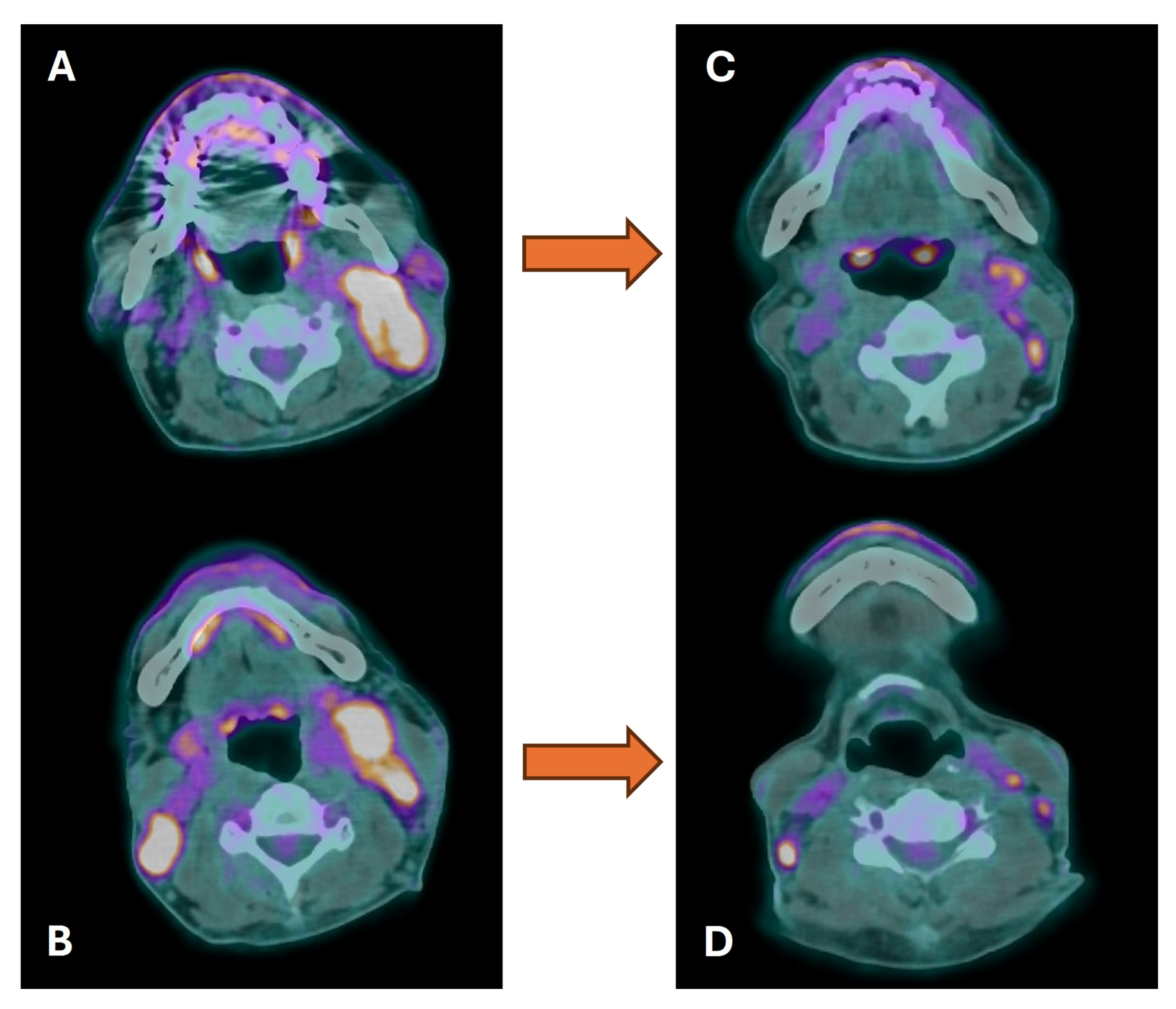 Cancers 16 01905 g006