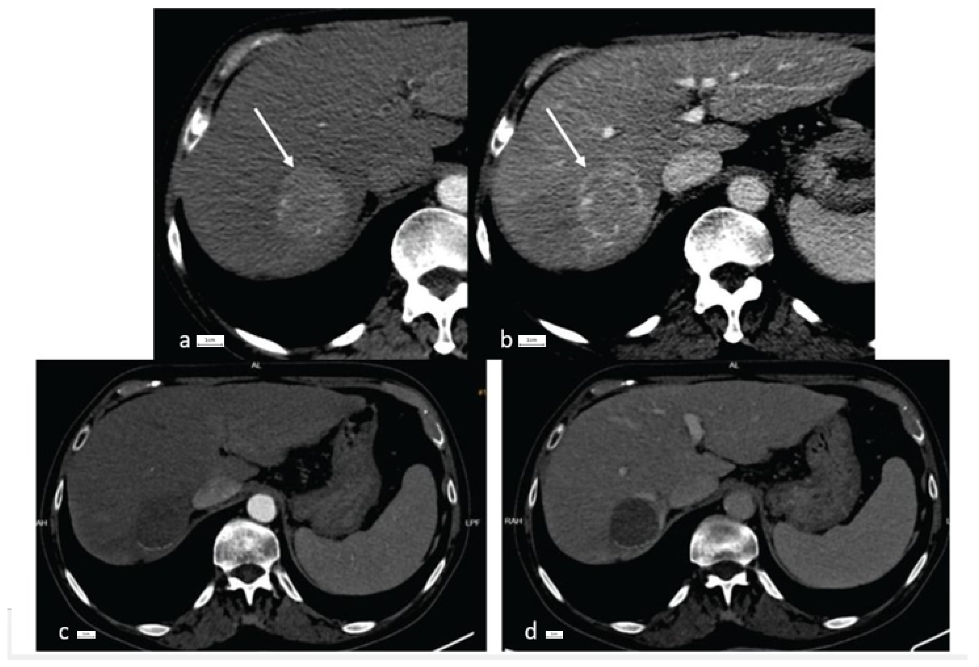 Cancers 16 01916 g001