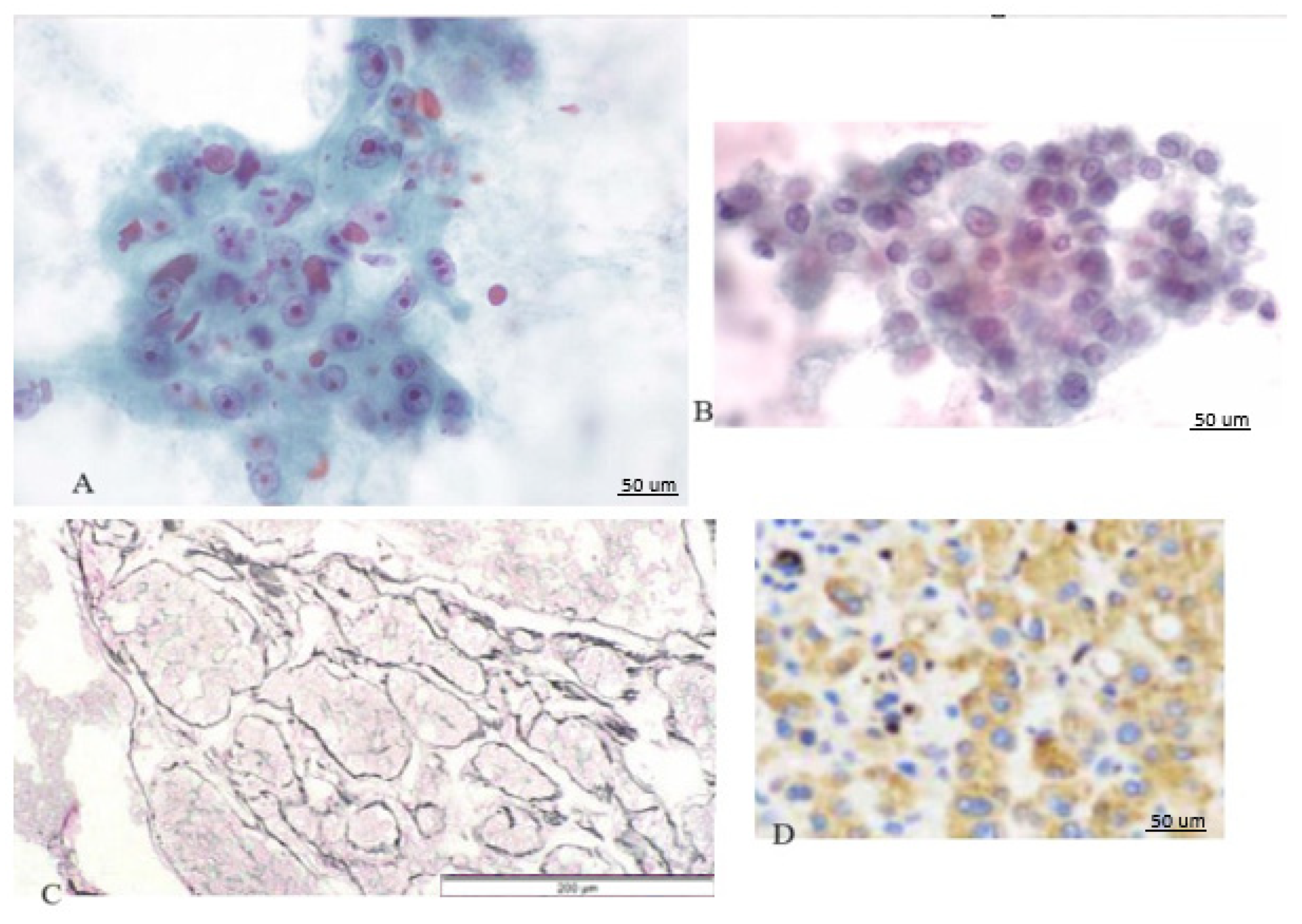 Cancers 16 01916 g002