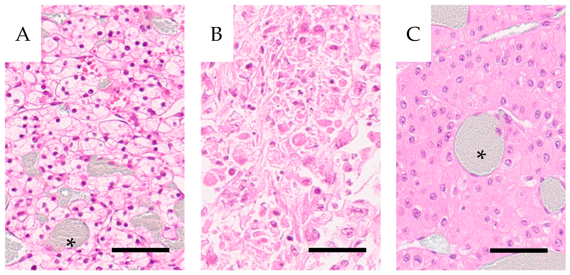 Cancers 16 01939 g002