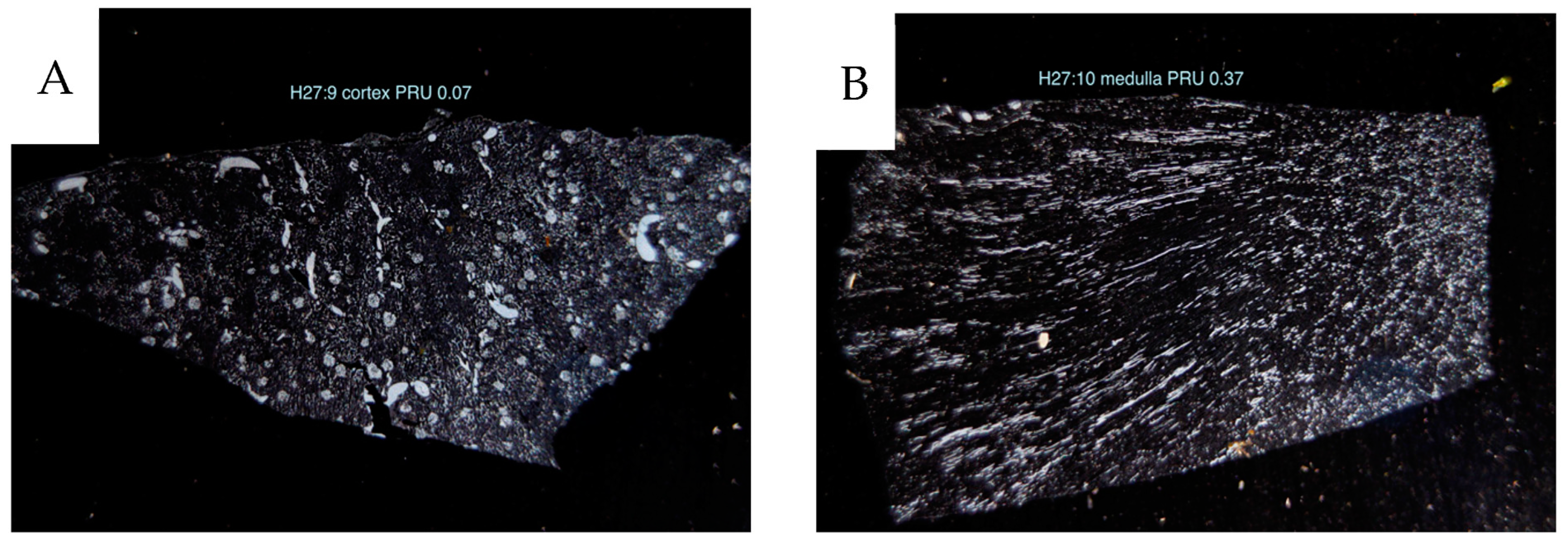 Cancers 16 01939 g005