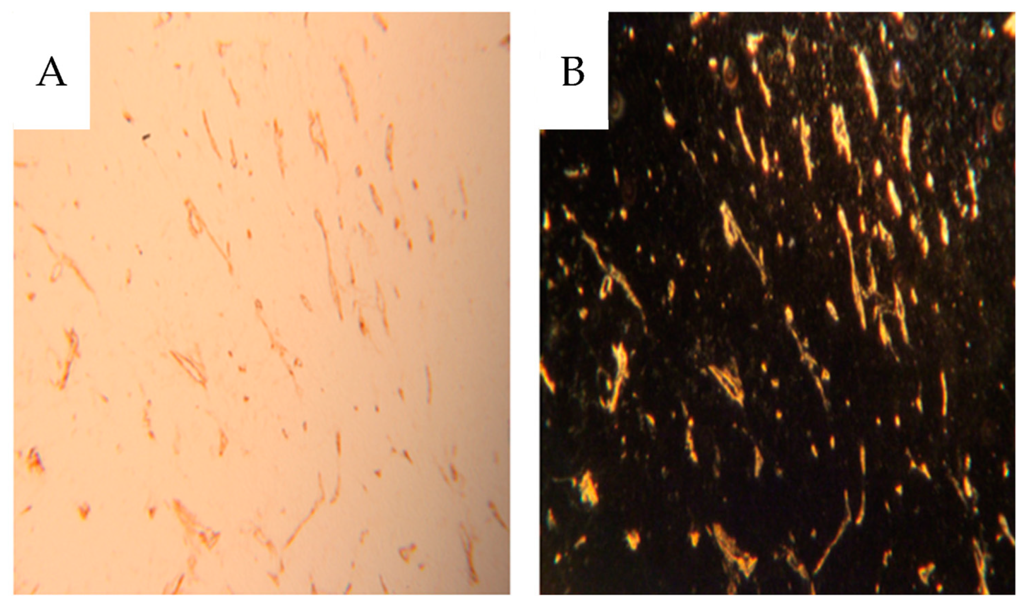 Cancers 16 01939 g007