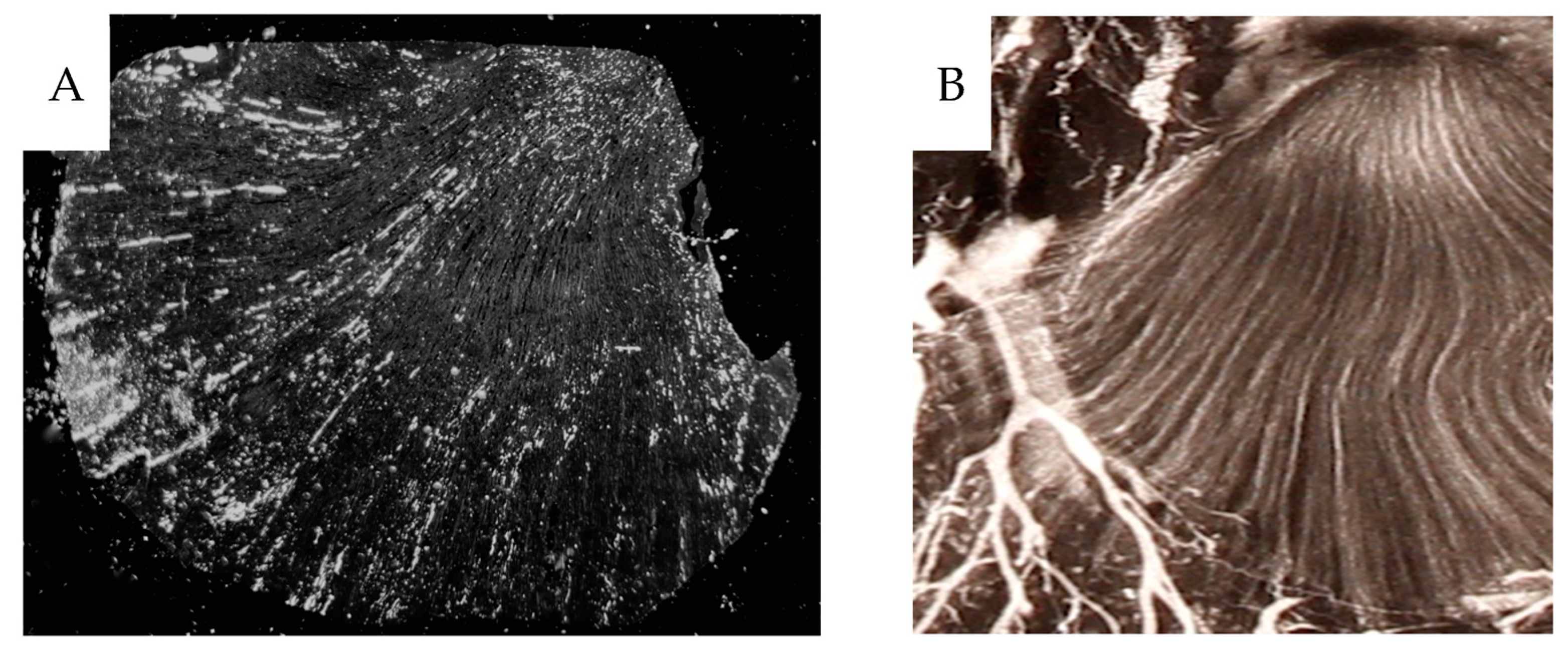 Cancers 16 01939 g008