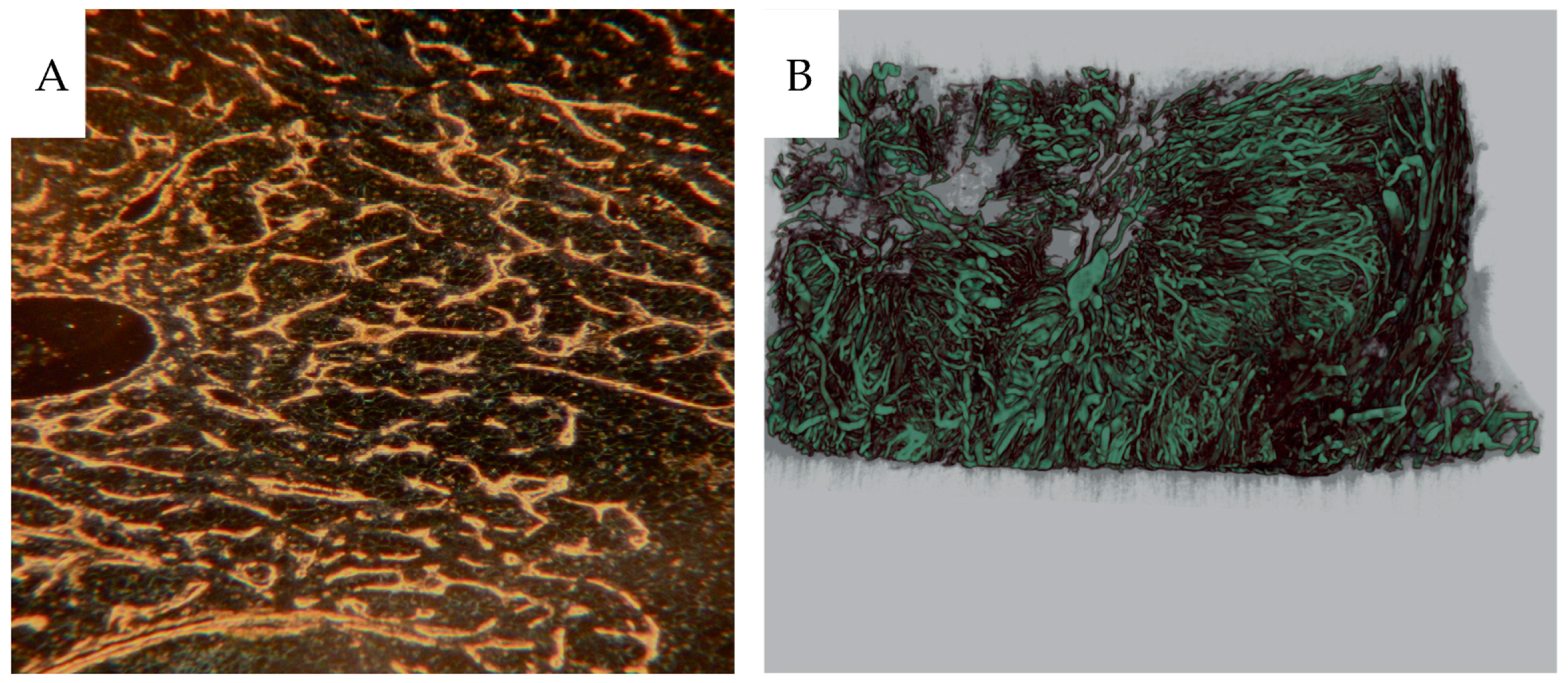 Cancers 16 01939 g013