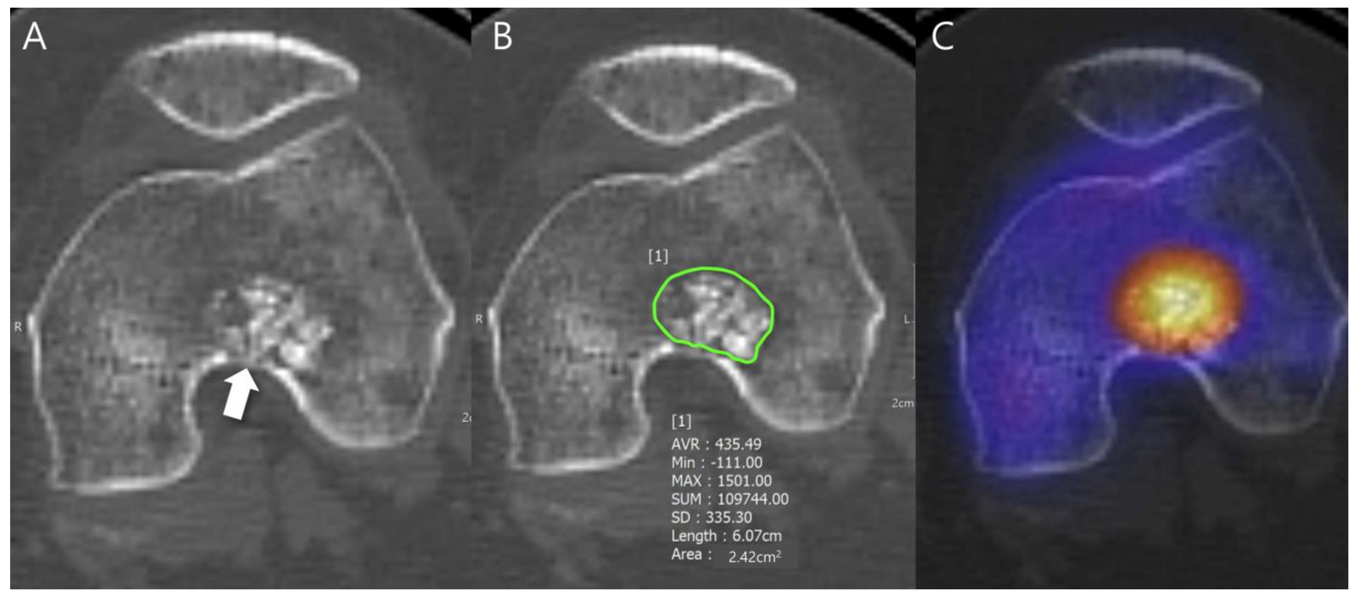 Cancers 16 01968 g001