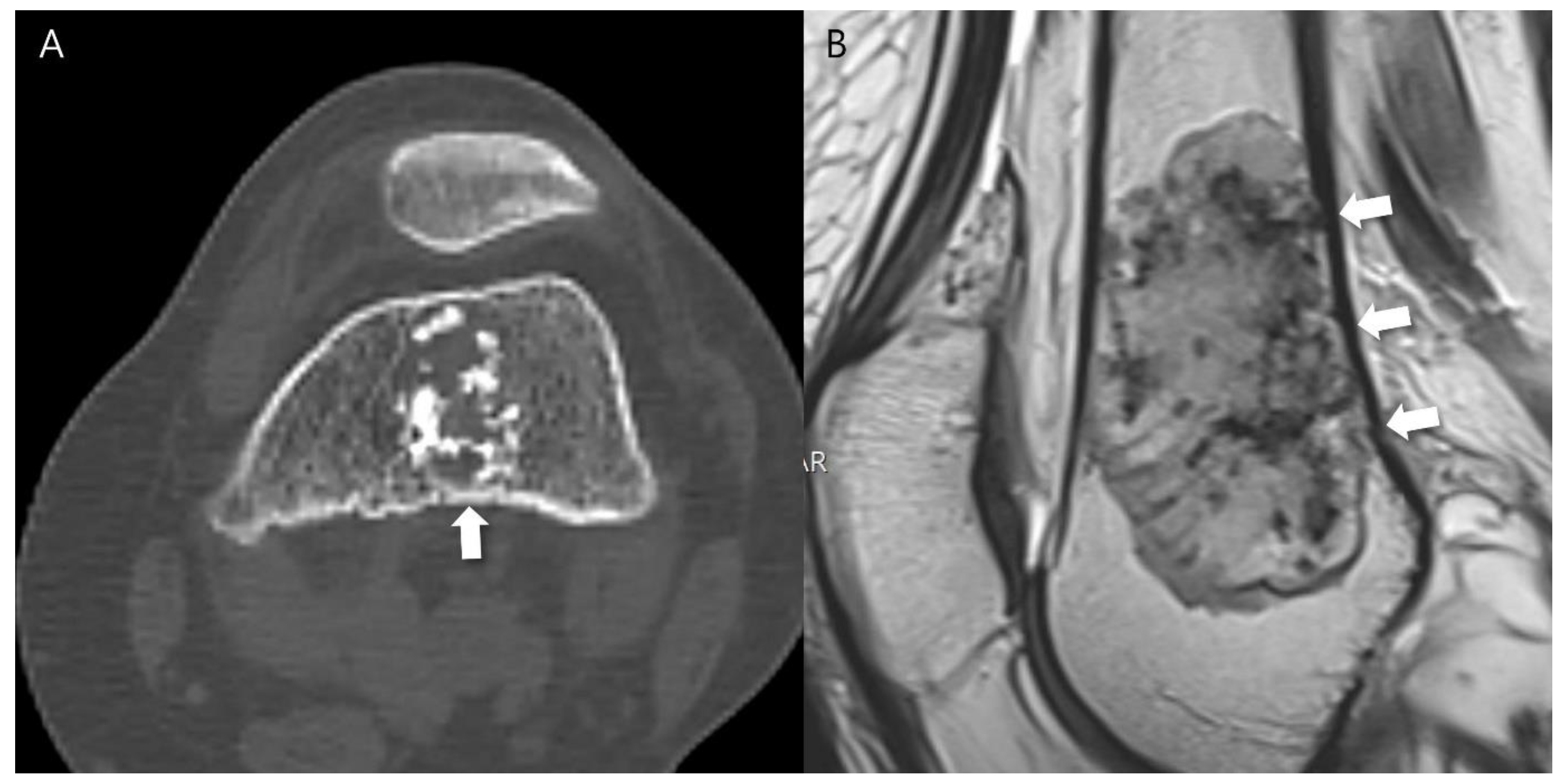 Cancers 16 01968 g002