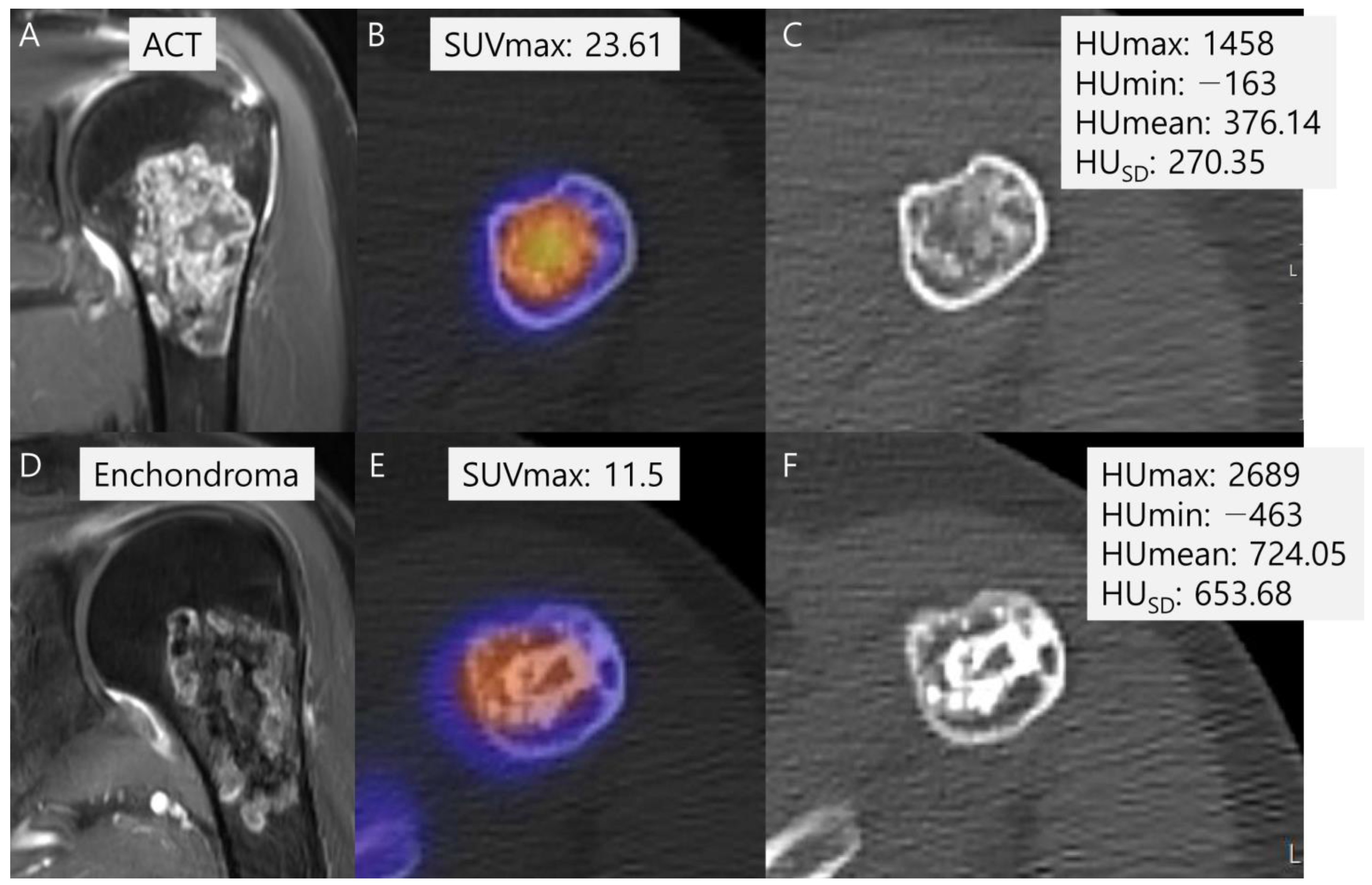 Cancers 16 01968 g006