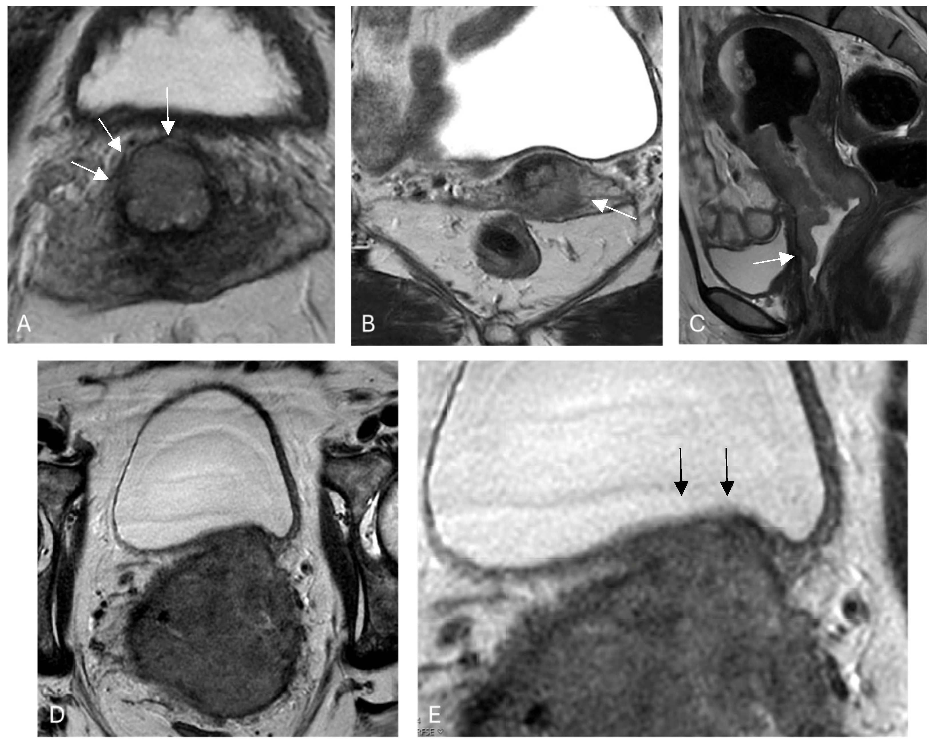 Cancers 16 01983 g002