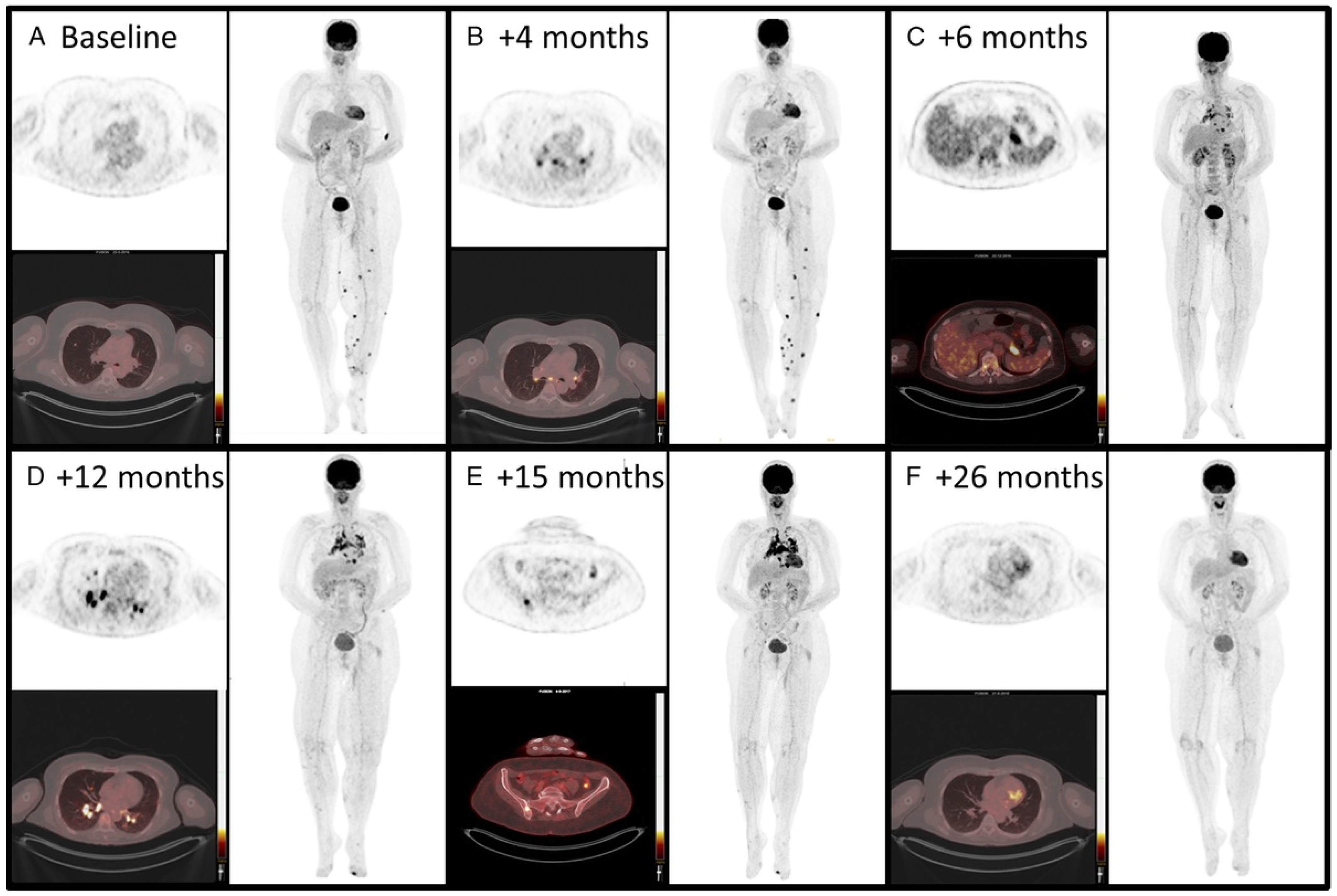 Cancers 16 01990 g007