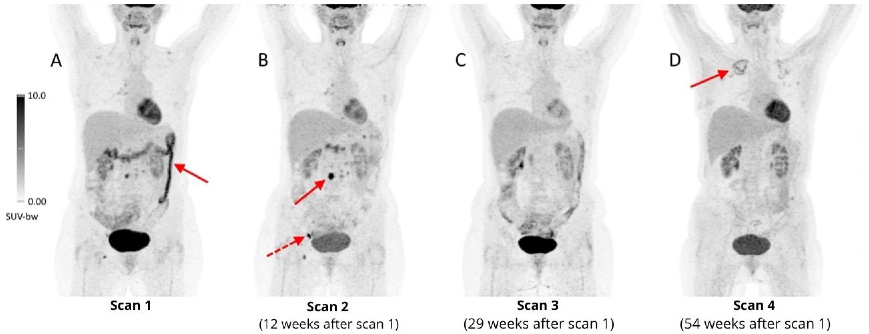 Cancers 16 01990 g008