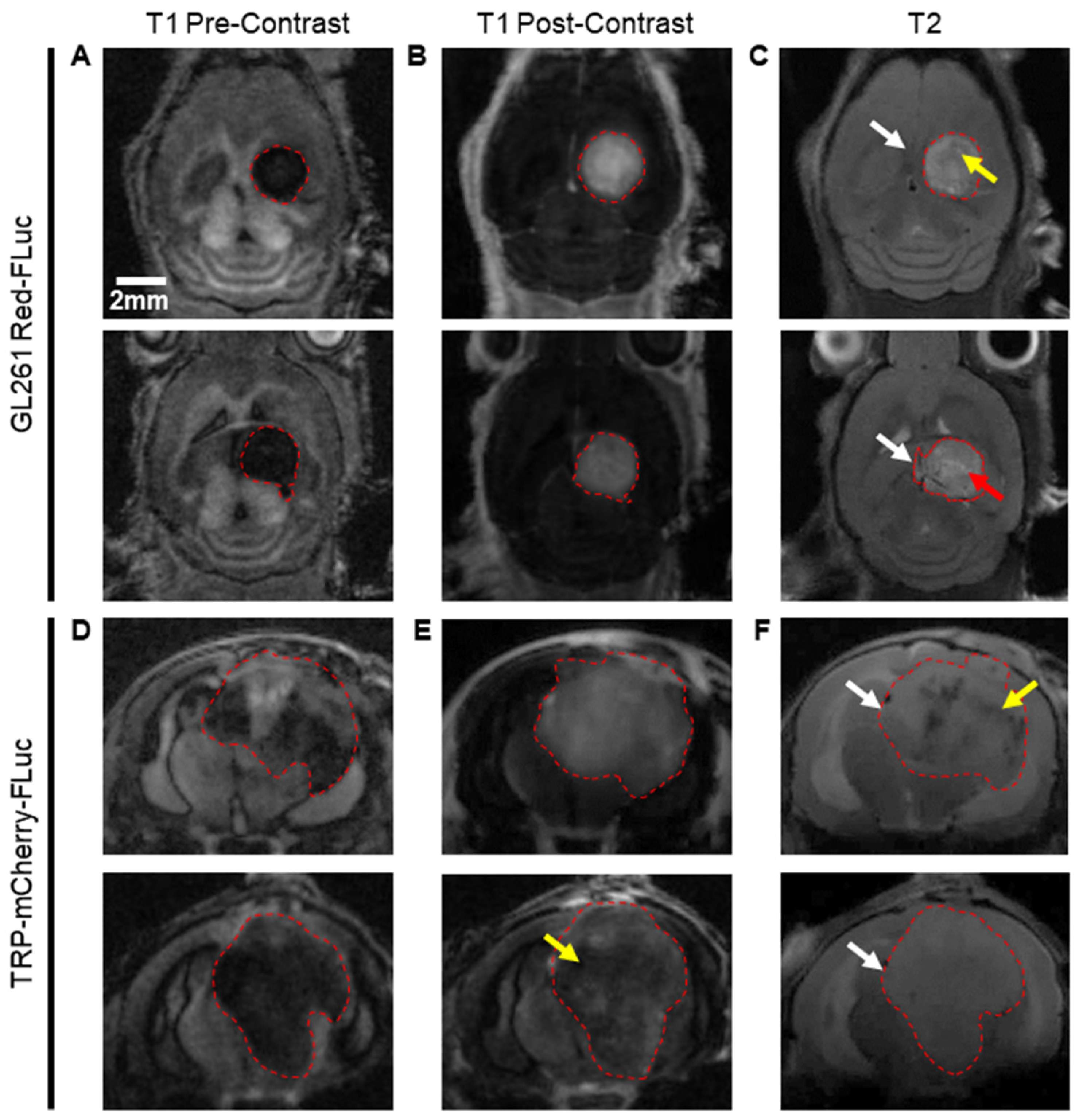 Cancers 16 01997 g005