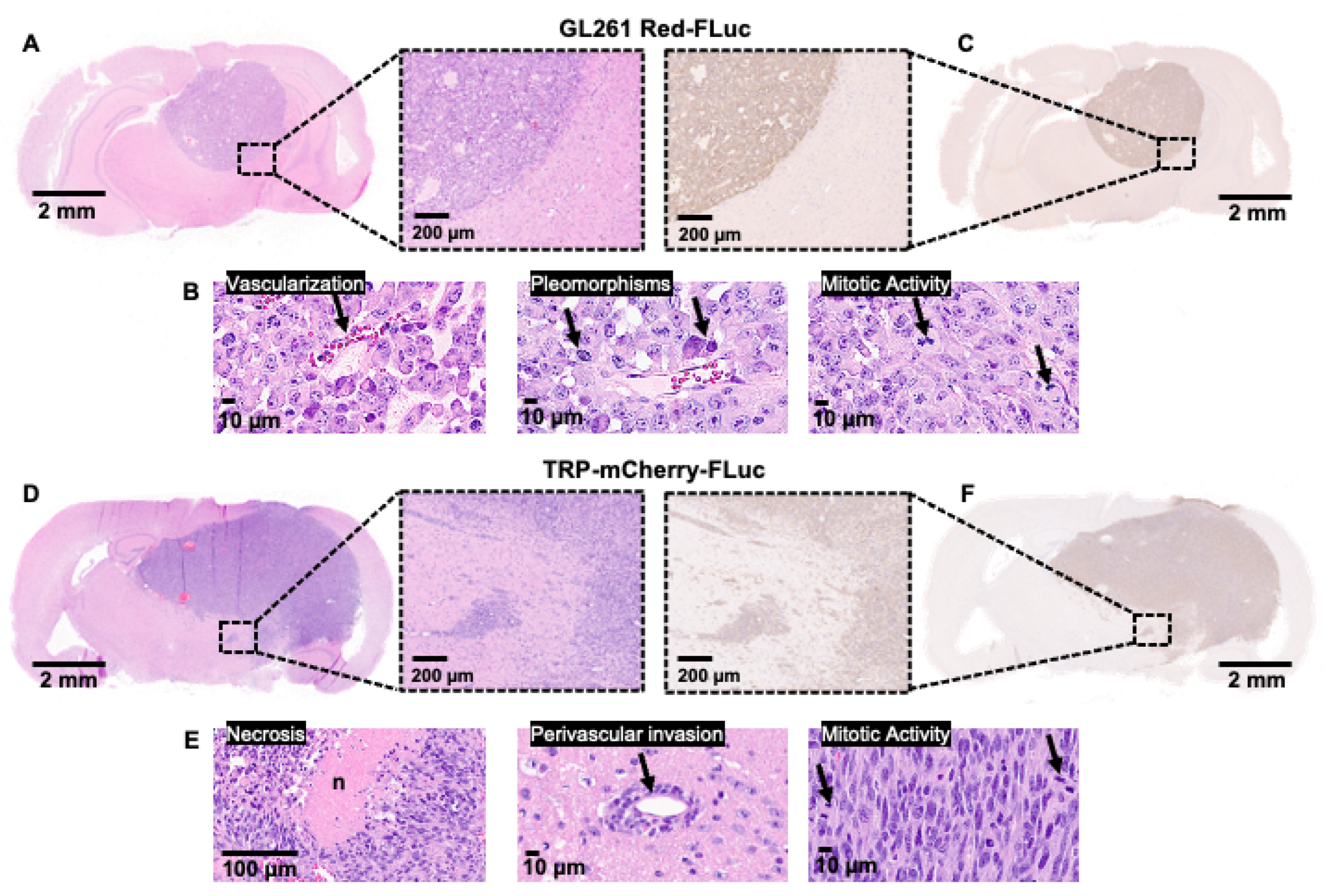 Cancers 16 01997 g006
